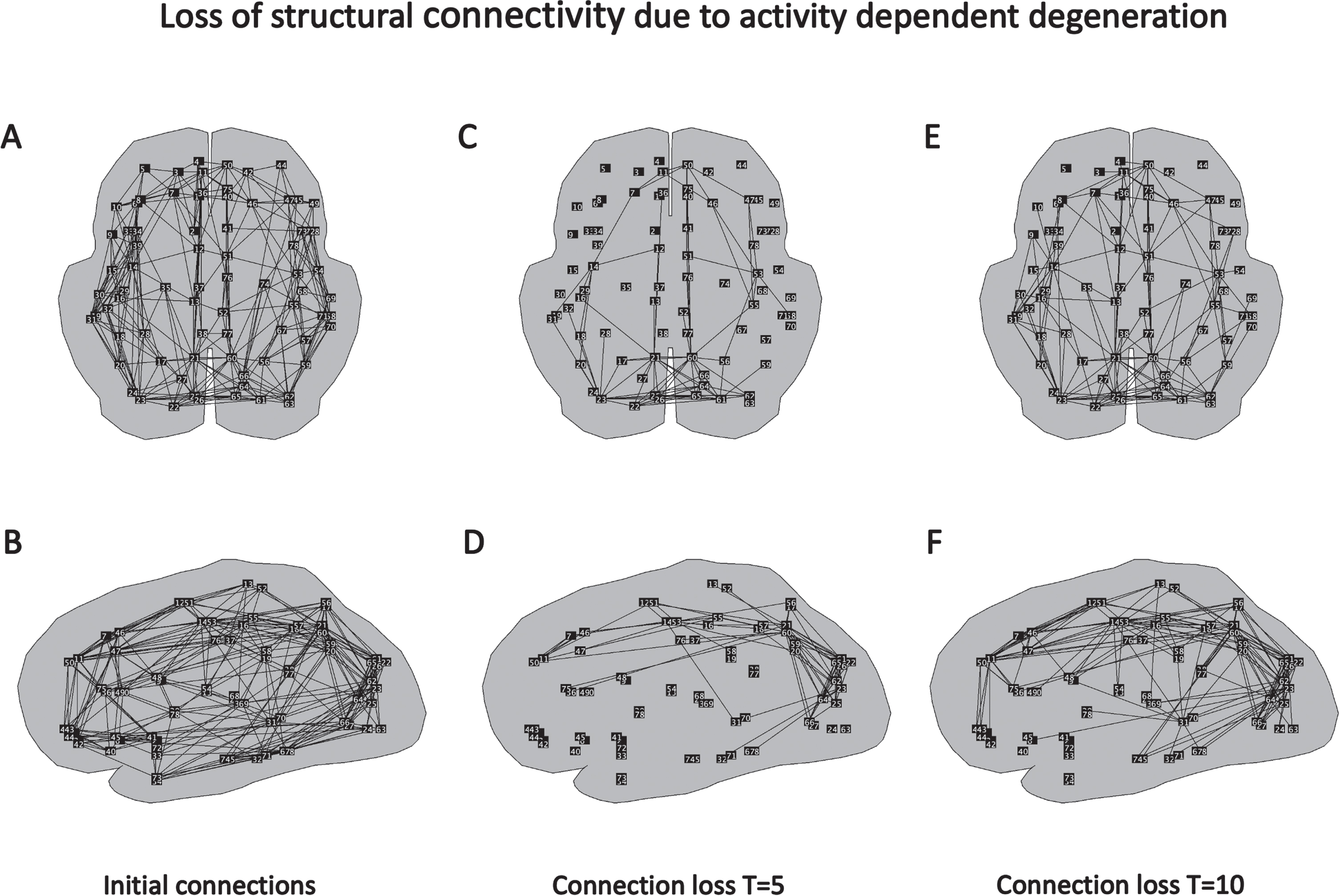 Spatial and temporal pattern of changes in structural connections in the global brain network induced by the ADD algorithm. A) Connections between brain regions in initial, healthy network, transversal view. B) Same network, sagittal view. C) Connections which have shown the strongest decrease in connection strength induced by the ADD algorithm at T = 5, transversal view. D) Same network, sagittal view. E) Connections with the strongest loss at T = 10, transversal view. F) Same network, sagittal view.