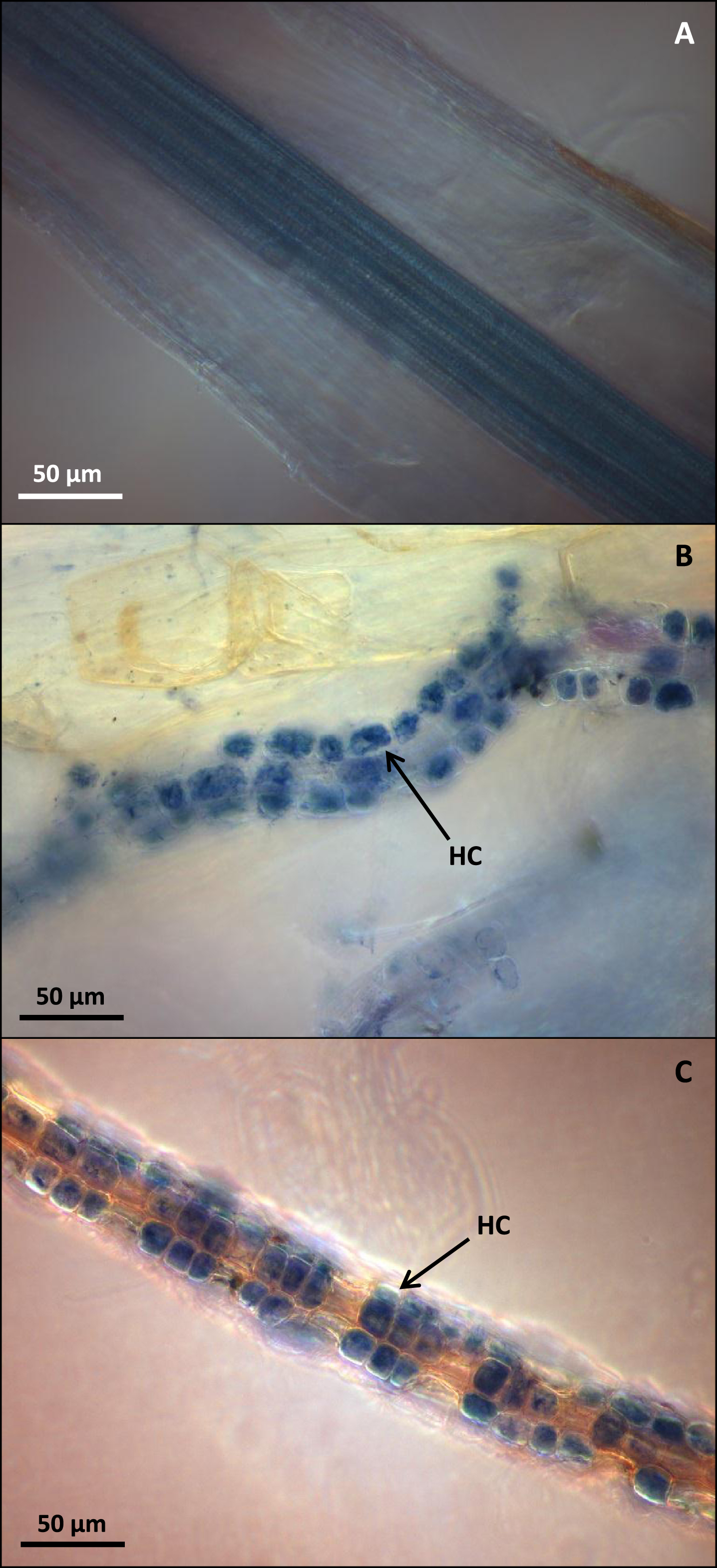 (A) C. vulgaris roots after KOH treatment and Trypan Blue staining resulting in total loss of root cortical cells. (B) Fresh C. vulgaris roots after staining in Trypan Blue for 10 minutes at room temperature and displaying intracellular hyphal coiling (HC). (C) Mycorrhizal C. vulgaris roots after freezing at –20 °C and staining with Trypan Blue and displaying intracellular hyphal coiling (HC). Bar = 50μm.