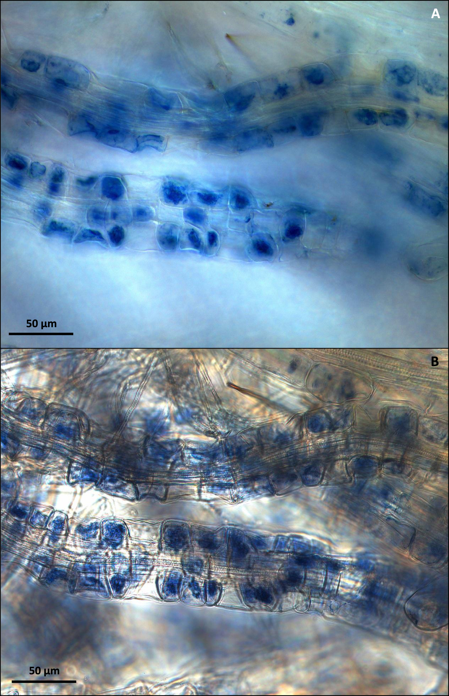 (A) C. vulgaris mycorrhizal roots visualized by high light-intensity dark field microscopy. (B) Comparative visualization of the same C. vulgaris mycorrhizal roots using bright field microscopy. Bar = 50μm.