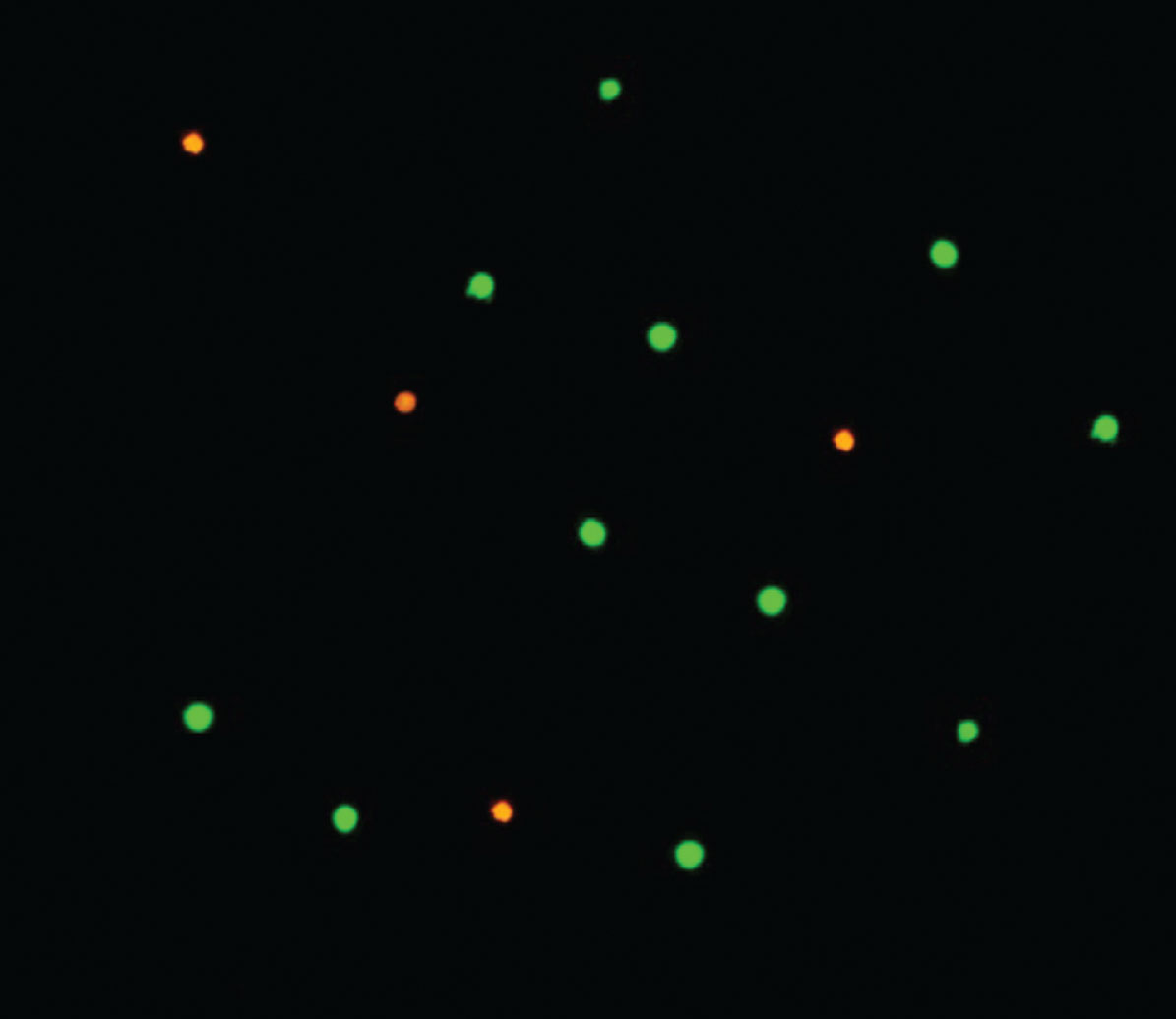 FDA/EtBr viability assay. Cell viability evaluation with the fluorescein diacetate and ethidium bromide differential staining method visualized in fluorescence microscope (magnification 100×). The green labelled cells are metabolically active and the red labelled cells are considered as dead.