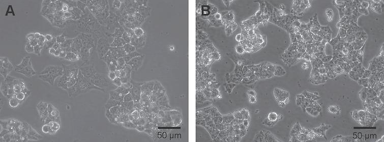 Cell morphology of HepG2 clone 9 is not different from parental HepG2. Phase contrast microscopy of HepG2 cells and clone 9 cultivated as monolayers to semi-confluence. (A) HepG2 cells (B) HepG2-3A4 clone 9 cultivated in the presence of blasticidin. Scale bar 50 μm.