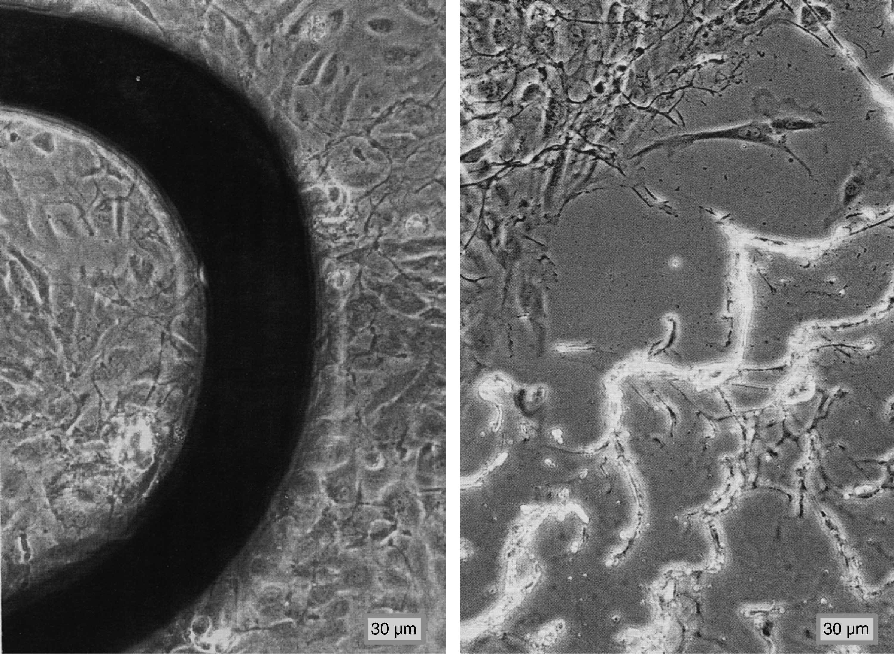 Model vascular wall consisting of functionally confluent human arterial endothelial cells (HUAEC) on extra cellular matrix (ECM) with impressed stent (left image; primary magnification: 1:200) and after removal of the stent (right image, primary magnification: 1:200).