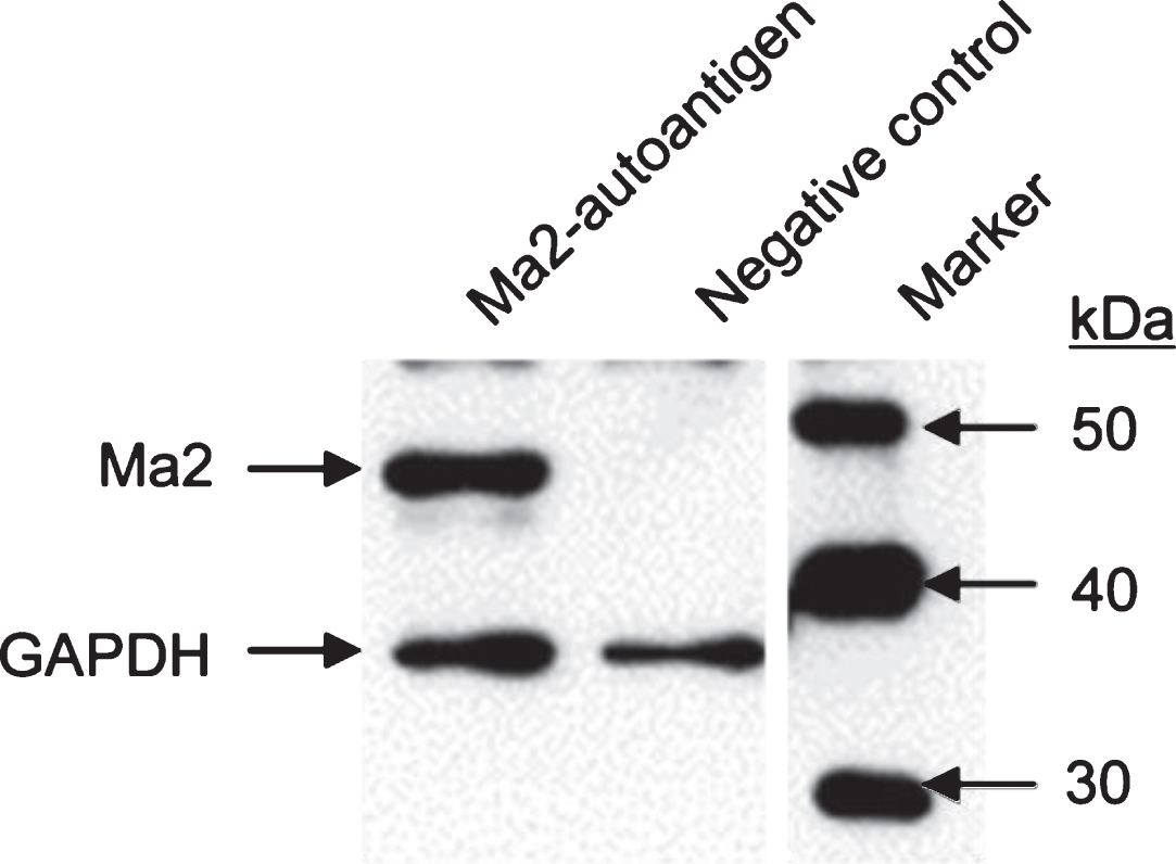 Western blot analysis of purified recombinant Ma2. E.coli BL21 (DE3) bacteria were transformed with pPSG-Ma2 expression plasmid for T7 promoter-controlled recombinant protein production. Protein expression was induced by IPTG for overnight at 18°C. Protein extracts were prepared, separated by SDS-PAGE and further processed for Western blot analysis. The membrane was incubated with primary anti-PNMA2 antibody and HRP-conjugated secondary antibodies. Western blot was developed using enhanced chemiluminescence (ECL), exposure time was 30 sec. Housekeeping gene product glyceraldehyde-3-phosphate dehydrogenase (GAPDH) was included as loading control. Magic Mark Western Protein Standard was applied as size marker.