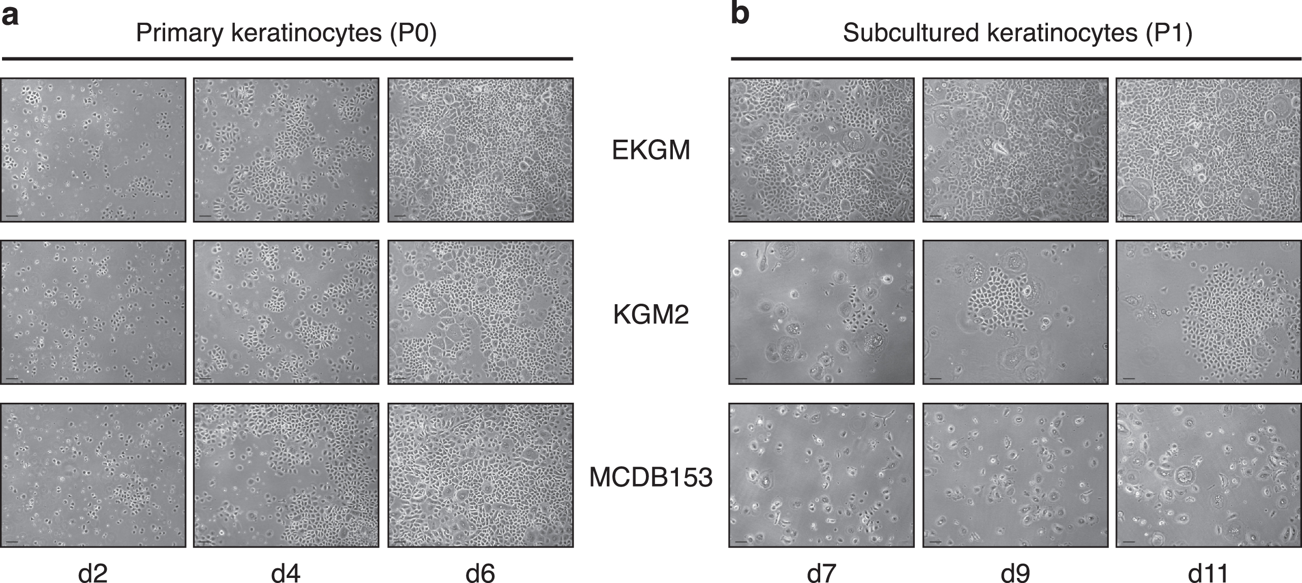 Comparison of different culture media on porcine keratinocyte growth and proliferation. Phase contrast images show in (a) primary keratinocytes at days 2, 4, and 6. All media used supported primary cell growth, resulting in high confluencies at day 6. In (b), phase contrast images show secondary keratinocytes (passage 1) at days 7, 9, and 11. EKGM effectively promoted secondary cell growth, resulting in high confluency already at day 7, KGM2 promoted growth in islands without leading to a complete confluence, whereas MCDB153 did not induce significant growth at all. Keratinocytes were seeded onto collagen-coated surfaces. Scales indicate 100 μm.