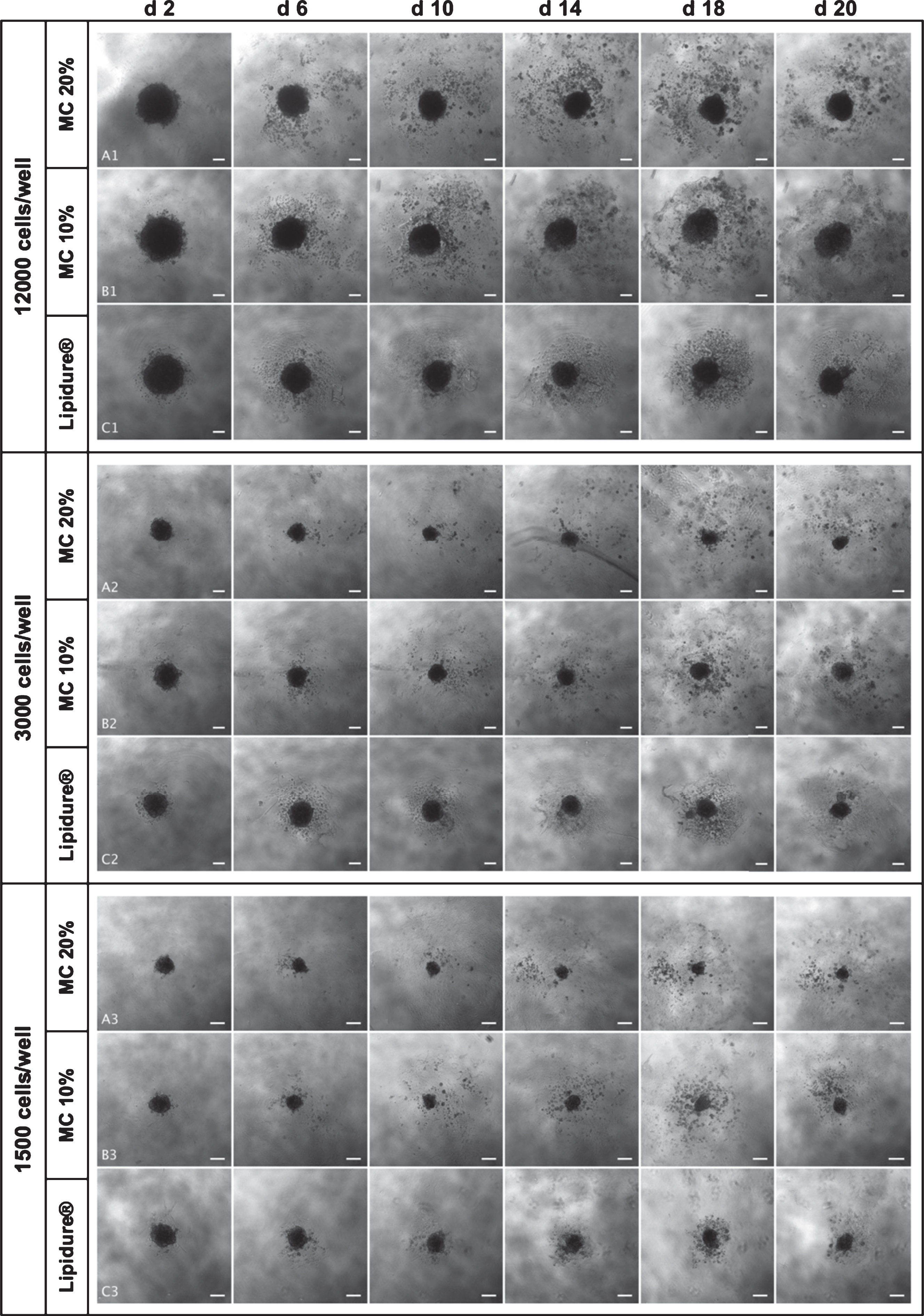 Representative phase-contrast microscopy images of in vitro generated SCC4 spheroids. The images were taken with a 5x objective. Spheroids were generated using 3 different methods: MC 20% (A1; A2; A3), MC10% (B1; B2; B3) and Lipidure© plate (C1; C2; C3). For each method, three different initial seeding densities were used (12,000, 3,000 and 1,500 cells/well). Spheroids were cultured until day 20. Only images from day 2, 6, 10, 14, 18 and 20 are shown. Scale bars correspond to 200μm.