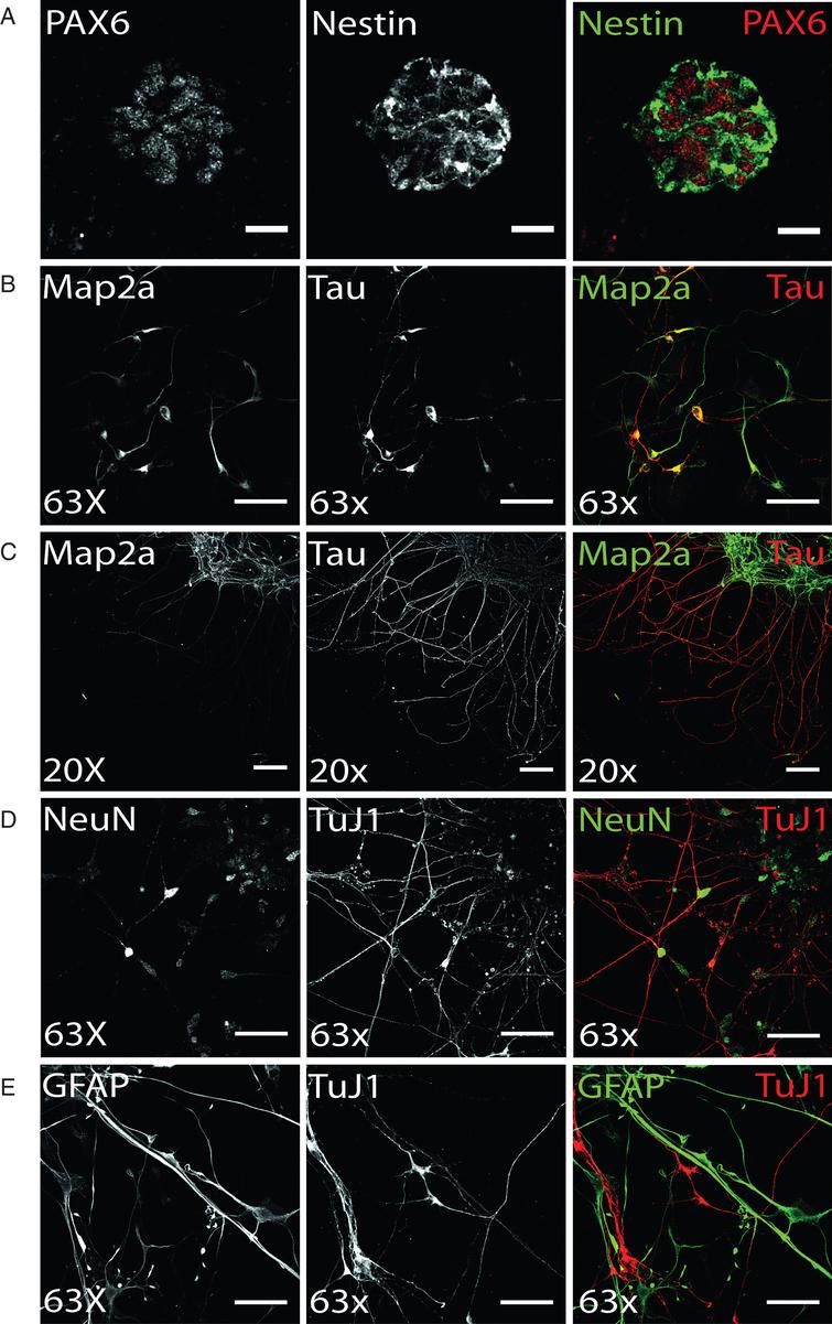 Differentiation of ventral midbrain DA NPCs into neural cells: (A) Exemplary Pax6 and Nestin immunostaining of DANPC, the starting point for terminal differentiation. PAX6 (red) shows nuclear expression of protein, whereas Nestin (green) signal is restricted to cytoplasm. Scale bar: 25μm. (B-D) Neuronal phenotype of hiPS cell-derived neurons was verified by immunofluorescence analysis for Map2a, Tau, NeuN, and TuJ1. (B) On d14 of terminal differentiation, neuronal polarity was only partially established, indicated by co-localized signal of axonal TAU and somatodendritic MAP2a. Scale bar: 50μm. (C) On d15 of terminal differentiation, neuronal polarity was established as shown by exclusively TAU-positive axonal and Map2a-positive dendritic networks. Scale bar: 100μm. (D) Exemplary immunostaining of neuronal maturation marker NeuN and neuronal structural marker TuJ1. Scale bar: 50μm. (E) Terminal differentiation of NPC gave also rise to glial cells, as shown by cells showing GFAP-positive, TuJ1-negative immunostaining (d50). Scale bar: 50μm.