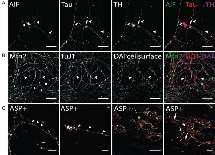 Immunocytochemical analysis of mitochondria distribution in hiPS cell-derived DA neurons and DAT specific uptake of fluorescent dye ASP+. (A) Immunostaining of mitochondrial intermembrane protein AIF in dopaminergic neurons after 50 days of terminal differentiation. AIF (green) is found to be present in cell soma and neurites (arrow heads). Dopaminergic neurons can be identified by co-localized signals of Tau (red) and TH (magenta). Scale bar: 50μm. (B) Mitochondrial fusion protein Mfn2 (green) can be visualized by immuno-cytochemistry and is evenly distributed throughout cells. Since not only neuronal cells are positively stained for Mfn2, co-staining with neuronal marker (here: TuJ1, red) and dopaminergic marker DAT was applied to identify Mfn-signals exhibited by DA neurons. Scale bar: 50μm. (C) Live cell imaging experiments in hiPS cell-derived DA neurons show DA-specific uptake of fluorescent ASP+ dye into neurons and accumulation in mitochondria. Zoom images show distribution of mitochondria along neurites and neurite endings, with mitochondrial morphology being round and punctual (arrow heads), whereas mitochondria located in cell somas are more elongated (arrows). Scale bar: 25μm, Zoom images: 5μm.