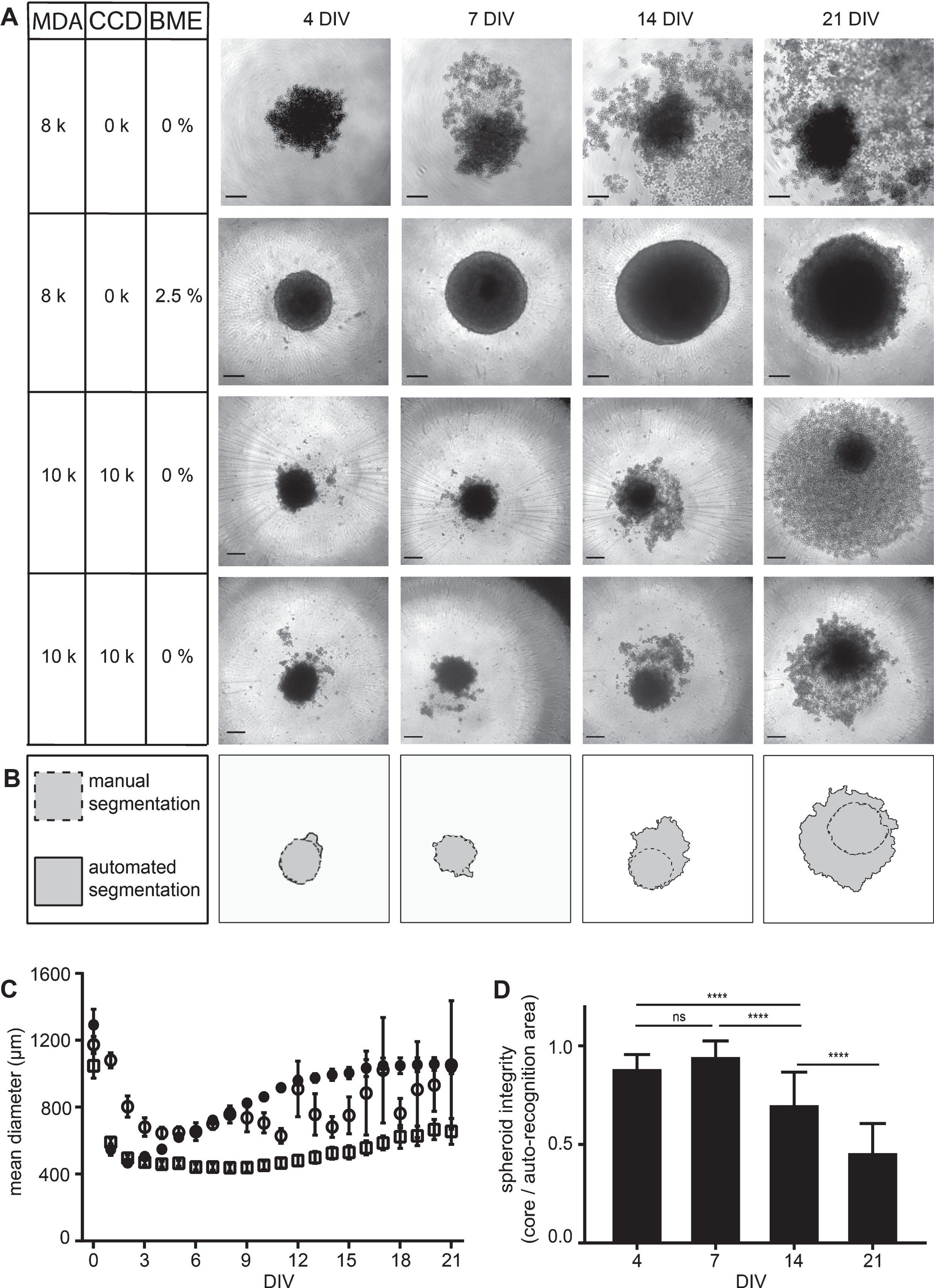 MDA-MB-231 spheroid integrity is preserved in the presence of BME and partially also achieved by co-culturing with CCD-1137Sk fibroblasts. MDA-MB-231 breast cancer cells were either cultured alone in ultra-low attachment plates for up to 21 DIV using MDA-M in the absence or presence of BME or in co-culture with CCD-1137Sk human fibroblasts in the absence of BME. (A) Brightfield micrographs of spheroids at 4, 7, 14, and 21 DIV under culture conditions as indicated with cell lines MDA-MB-231 (MDA) and CCD-1137Sk (CCD) supplemented with basal membrane extract (BME). For co-cultures, two data sets are shown to illustrate the variability in spheroid disintegration. Scale bars, 200 μm. (B) Difference between automated (solid outline) and manual segmentation (dashed outline) using SpheroidSizer as illustrated on the lower panels in (A). (C) Quantiative analysis of spheroid diameters as a function of DIV. Depicted are mean values±SD. For each data point, at least 12 spheroids were analysed. (D) Quotient of manually versus automatically segmented spheroid areas as a measure of spheroid integrity. Depicted are mean values±SD. For each data point, at least 40 spheroids were analysed.
