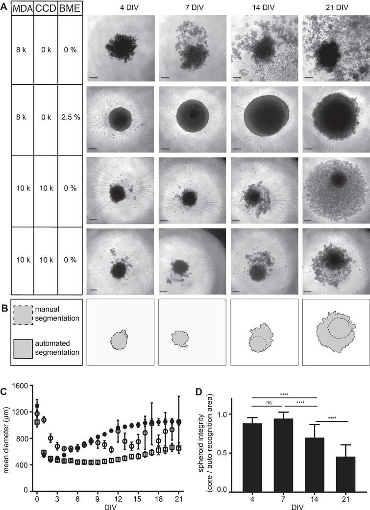 MDA-MB-231 spheroid integrity is preserved in the presence of BME and partially also achieved by co-culturing with CCD-1137Sk fibroblasts. MDA-MB-231 breast cancer cells were either cultured alone in ultra-low attachment plates for up to 21 DIV using MDA-M in the absence or presence of BME or in co-culture with CCD-1137Sk human fibroblasts in the absence of BME. (A) Brightfield micrographs of spheroids at 4, 7, 14, and 21 DIV under culture conditions as indicated with cell lines MDA-MB-231 (MDA) and CCD-1137Sk (CCD) supplemented with basal membrane extract (BME). For co-cultures, two data sets are shown to illustrate the variability in spheroid disintegration. Scale bars, 200 μm. (B) Difference between automated (solid outline) and manual segmentation (dashed outline) using SpheroidSizer as illustrated on the lower panels in (A). (C) Quantiative analysis of spheroid diameters as a function of DIV. Depicted are mean values±SD. For each data point, at least 12 spheroids were analysed. (D) Quotient of manually versus automatically segmented spheroid areas as a measure of spheroid integrity. Depicted are mean values±SD. For each data point, at least 40 spheroids were analysed.