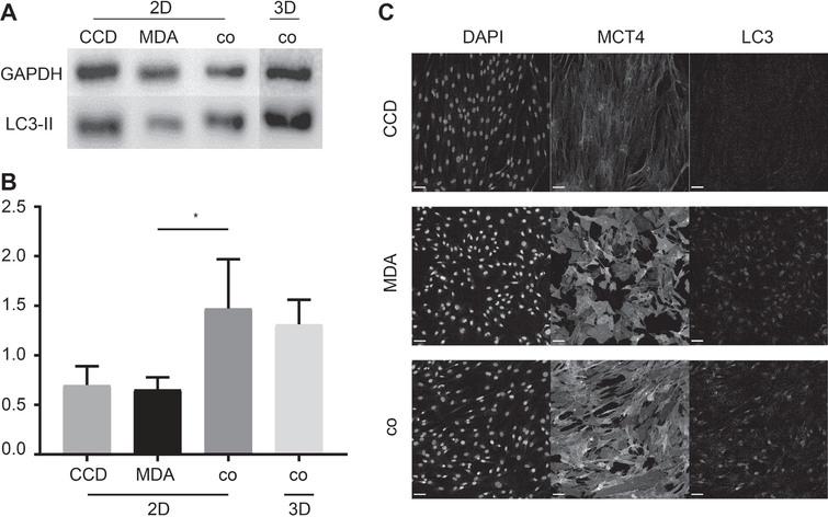 Co-cultures of MDA-MB-231 and CCD-1137Sk cells exhibit higher levels of LC3-II and MCT4 expression. MDA-MB-231 breast cancer cells and CCD-1137 fibroblasts were either cultured alone as adherent cultures (2D) or co-cultured in 2D (2D) or in ultra-low attachment plates (3D) for 4 DIV. Then, cells were analysed by Western blot (A-B) or immunofluorescence (C). (A) Representative Western blot bands upon staining against LC3-II or GAPDH. (B) Quantitative analysis of LC3-II band intensities upon normalization to GAPDH. Depicted are mean + SD. At least 3 experimental replicates were made. (C) Confocal images of representative 2D regions stained for nuclei (DAPI), MCT4, and LC3. Scale bars, 100 μm.