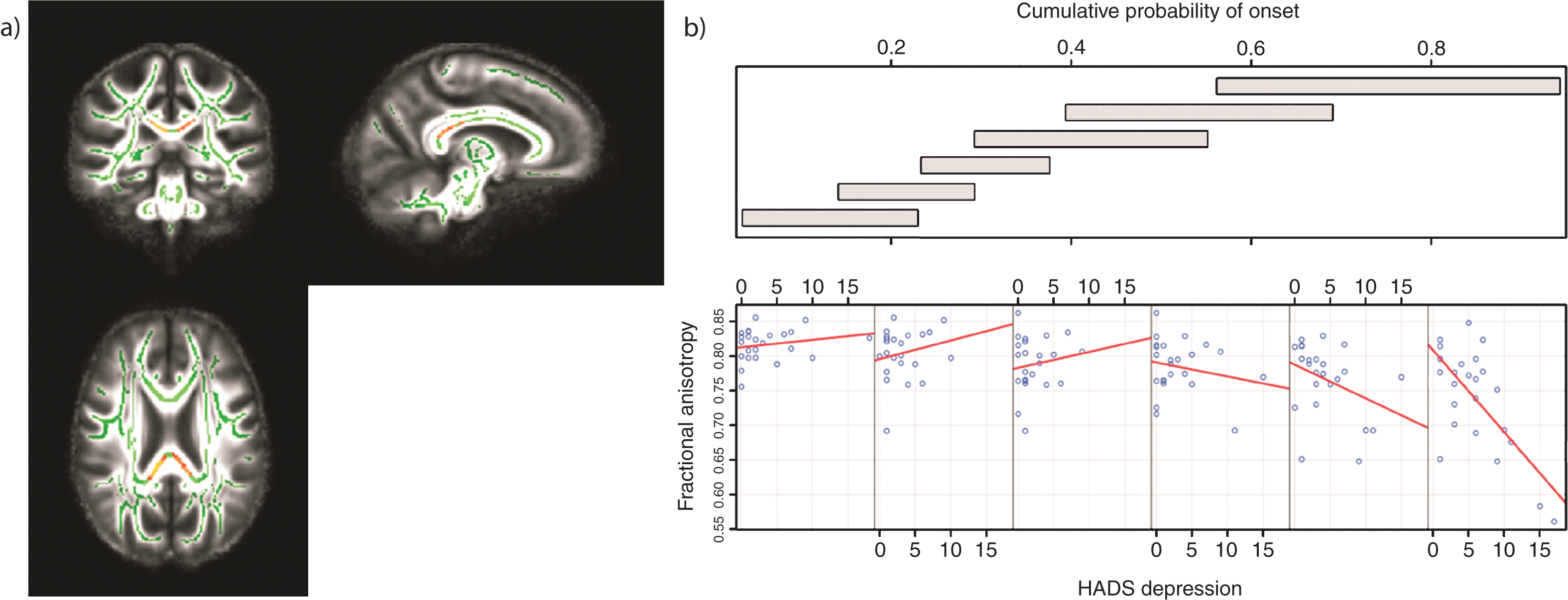 Tracts in which reduced FA was correlated with increased levels of depression in those with high CPO; FWE -corrected threshold of P <  0.05. a) Results (red-yellow) are projected on a white matter skeleton (green), overlaid on a customized mean FA image. b) FA as a function of HADS depression (lower scatterplots), conditional on CPO (upper panel). The upper panel depicts the overlapping ranges of CPO that determine the subsample of each scatterplot. A linear regression line was fit for each scatterplot to aid interpretation.