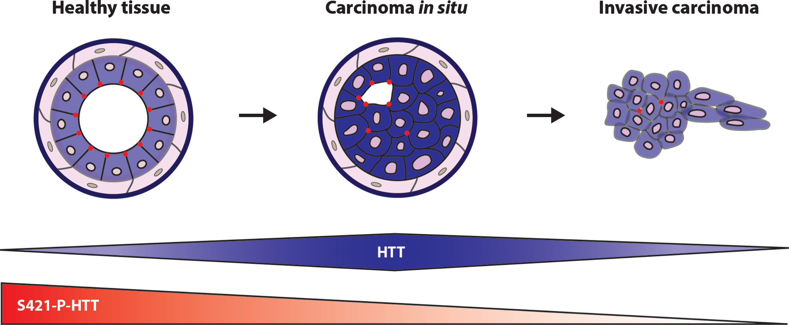 HTT and S421-P-HTT during tumor progression. Schematic representation of HTT cellular localization and S421-P-HTT during mammary gland tumor progression. (from [30]).