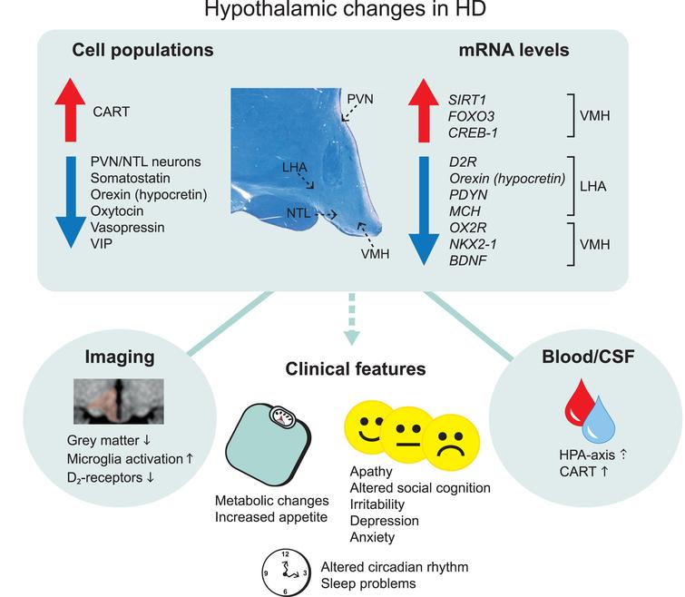 Overview of main hypothalamic changes in Huntington’s disease. Altered immunoreactivity and gene expression levels of cell populations detected in specific hypothalamic nuclei. Changes that result in upregulation and downregulation are indicated by the arrows. The location of specific hypothalamic nuclei is indicated by the dashed arrows on the cross-sectional human hypothalamic section stained for Cresyl violet and Luxol fast blue. Hypothalamic changes are also detected in the blood and cerebrospinal fluid as well as from different imaging paradigms. These changes are thought to be a key contributor to the clinical features in Huntington’s disease. CART, cocaine and amphetamine regulated transcript; CREB-1, cyclic AMP-responsive element-binding protein 1; D2R, dopamine D2 receptor; FOXO3, Forkhead box O3; HPA, hypothalamic–pituitary–adrenal; LHA, lateral hypothalamic area; MCH, melanin-concentrating hormone; NTL, nucleus tuberalis lateralis; NKX2-1, NK2 homeobox 1; OX2R, Orexin 2 receptor; PVN, paraventricular nucleus; PDYN, prodynorphin, SIRT1, sirtuin 1; VIP, vasoactive intestinal peptide; VMH, ventromedial hypothalamus.