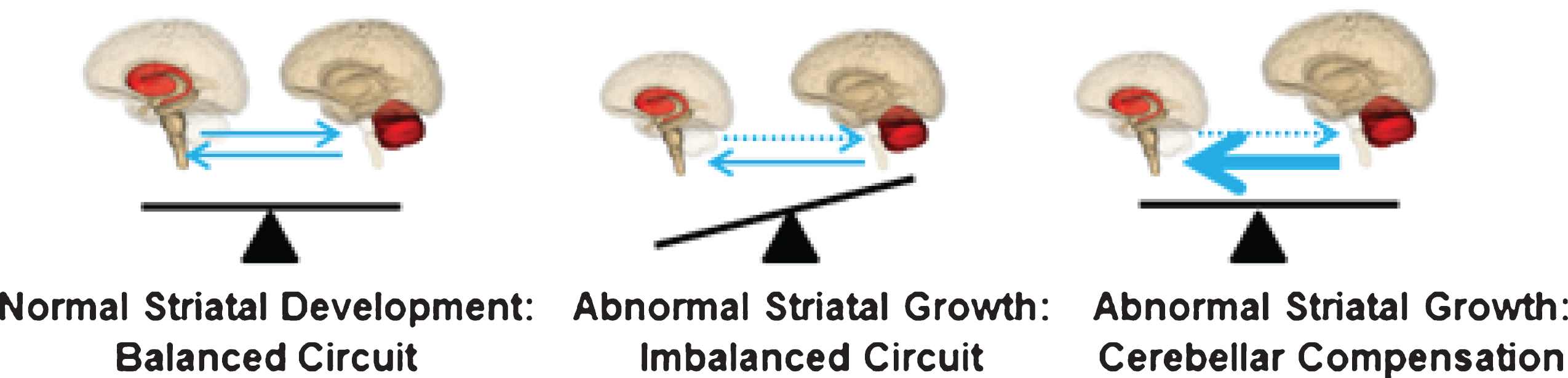 Model of cerebellar compensation of the abnormally developed striatum in HD. The compensation allows for normal motor function and maintains the striatum in mutant steady state.