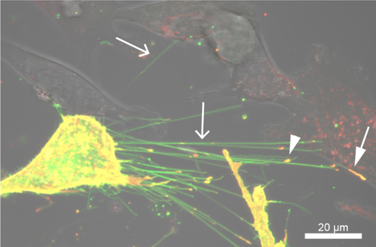 Rhes promotes TNT-like cellular protrusions in striatal neuronal cells. Confocal and DIC images of striatal cells expressing EGFP-Rhes and mCherry-tagged caveolin-1. Arrow indicates TNT, the arrowhead indicates caveolin-1 in the TNT, and the closed arrow indicates caveolin-positive TNT in the adjacent cell.