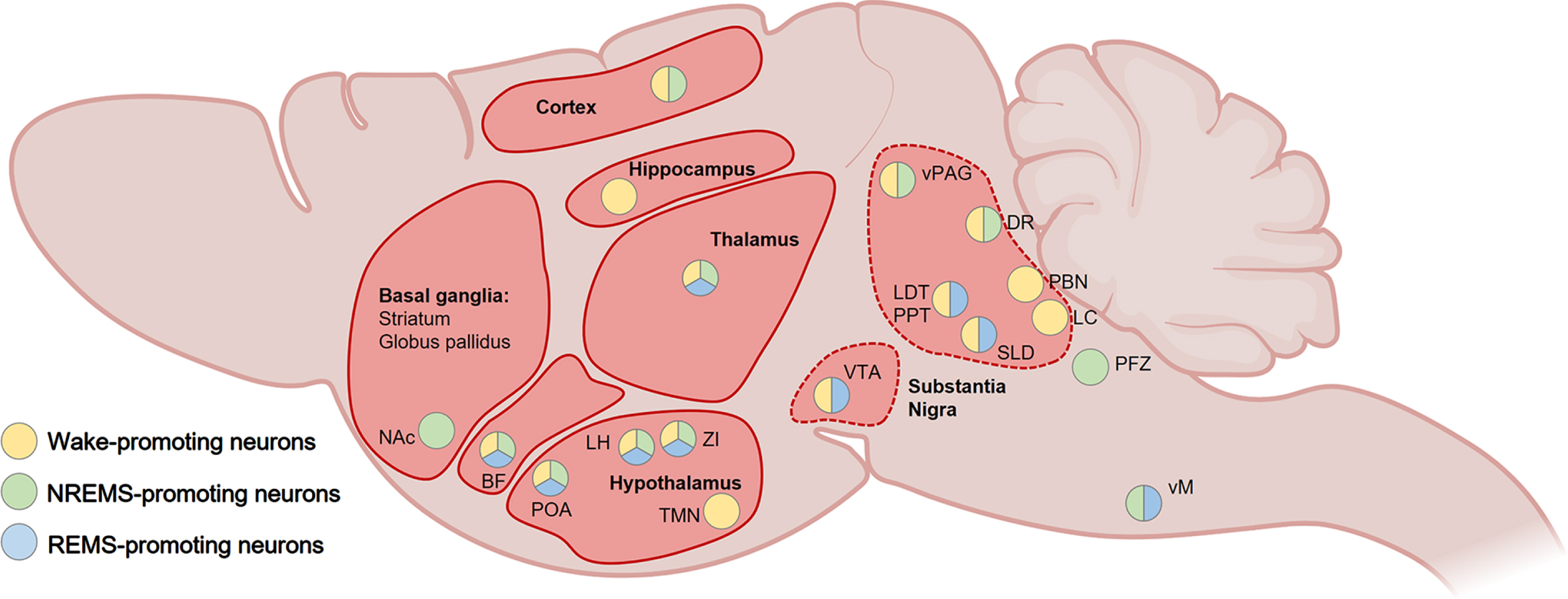 Examples of overlaps between wake- and sleep-regulating neurons and various neurodegenerative diseases in the rodent brain. Several brain regions that exhibit neuropathological alterations in Alzheimer’s disease (e.g., hippocampus, neocortex, basal forebrain, thalamus, hypothalamus, striatum, brainstem), Parkinson’s disease (e.g., basal ganglia, substantia nigra, thalamus, hypothalamus) or Huntington’s disease (e.g., basal ganglia, substantia nigra, thalamus, hypothalamus) share neuronal signaling pathways with regions exerting control over sleep and wakefulness. BF, basal forebrain; DR, dorsal raphe; LC, locus coeruleus; LDT, laterodorsal tegmental nucleus; LH, lateral hypothalamus; NAc, nucleus accumbens; PBN, parabrachial nucleus; POA, preoptic area of the hypothalamus; PPT, pedunculopontine tegmental nucleus; PFZ, parafacial zone; SLD, sublaterodorsal tegmental nucleus; TMN, tuberomammillary nucleus of the hypothalamus; vM, vental medulla; vPAG, ventral periaqueductal gray; VTA, ventral tegmental area; ZI, zona incerta. Created with BioRender.com.