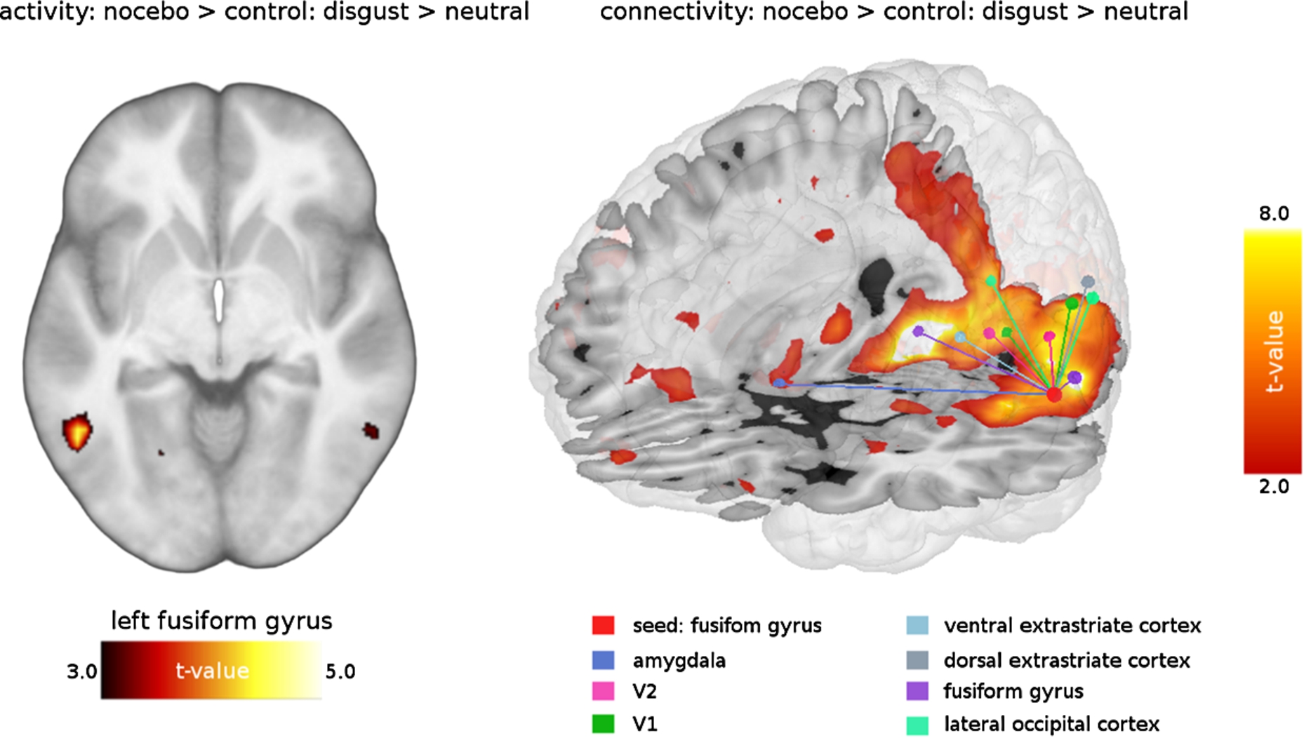 Nocebo-related activity and connectivity of fusiform gyrus during disgust elicitation.
