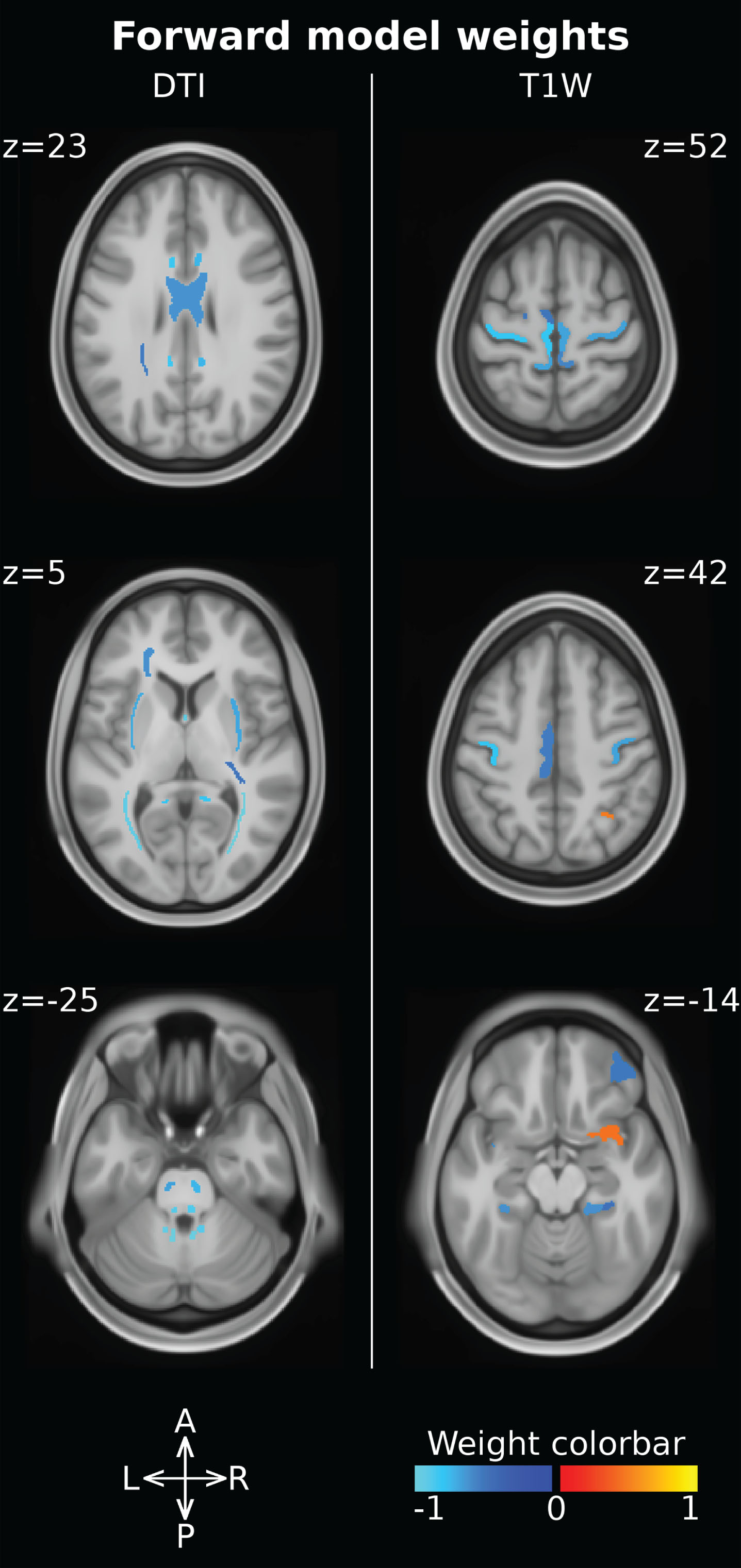 Forward model weights associated with the ROI measures. DTI-derived features (i.e. FA, MD) are reported on the left, while T1W-derived ones (i.e. cortical thickness, volume) are reported on the right. The ROI intensity and color-code are used to report the weight magnitude and sign, respectively.