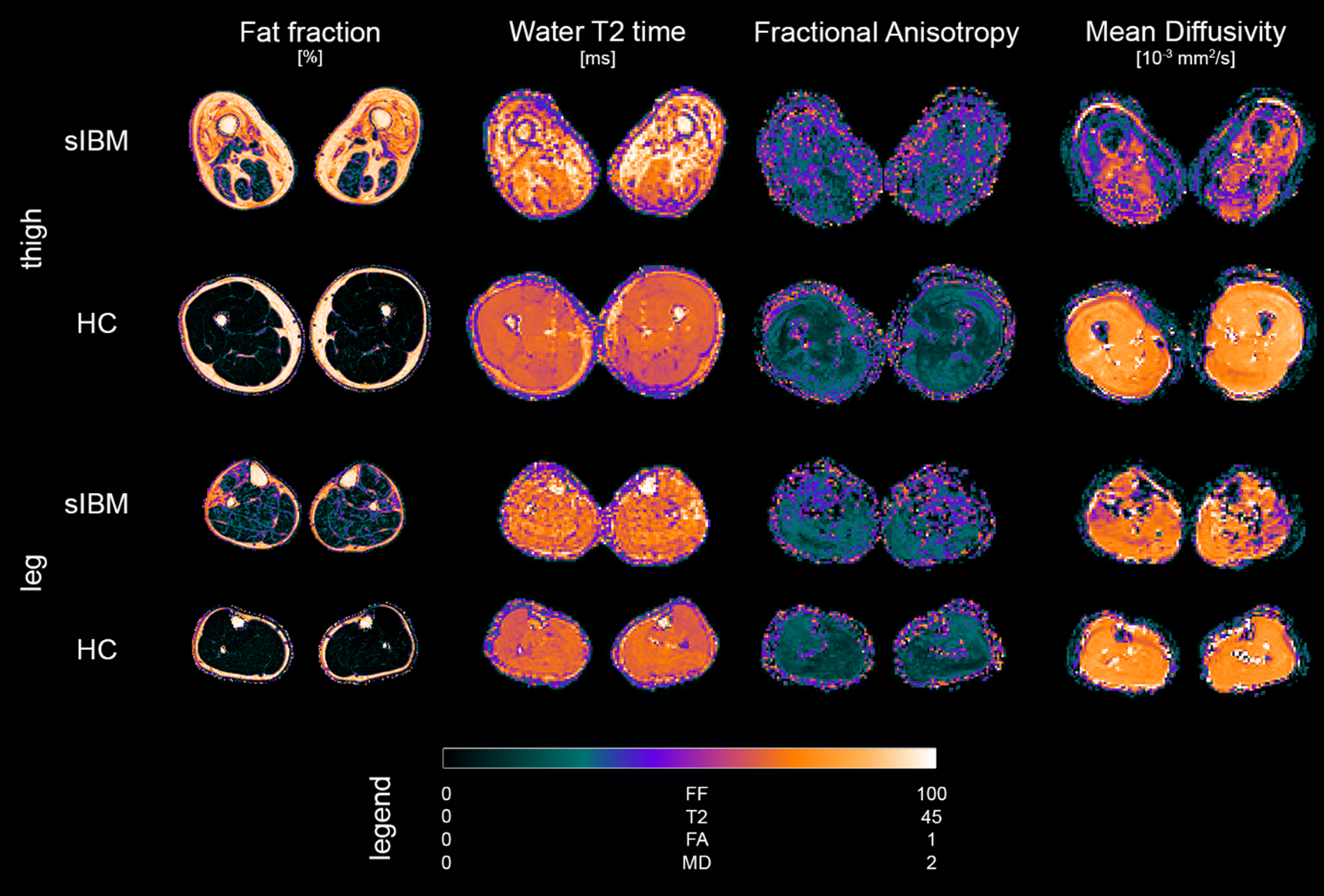 Overview of parameter maps for fat fraction (FF), water T2 relaxation time (T2), fractional anisotropy (FA), and mean diffusivity (MD) of representative sporadic inclusion body myositis patient (sIBM) and healthy control (HC).