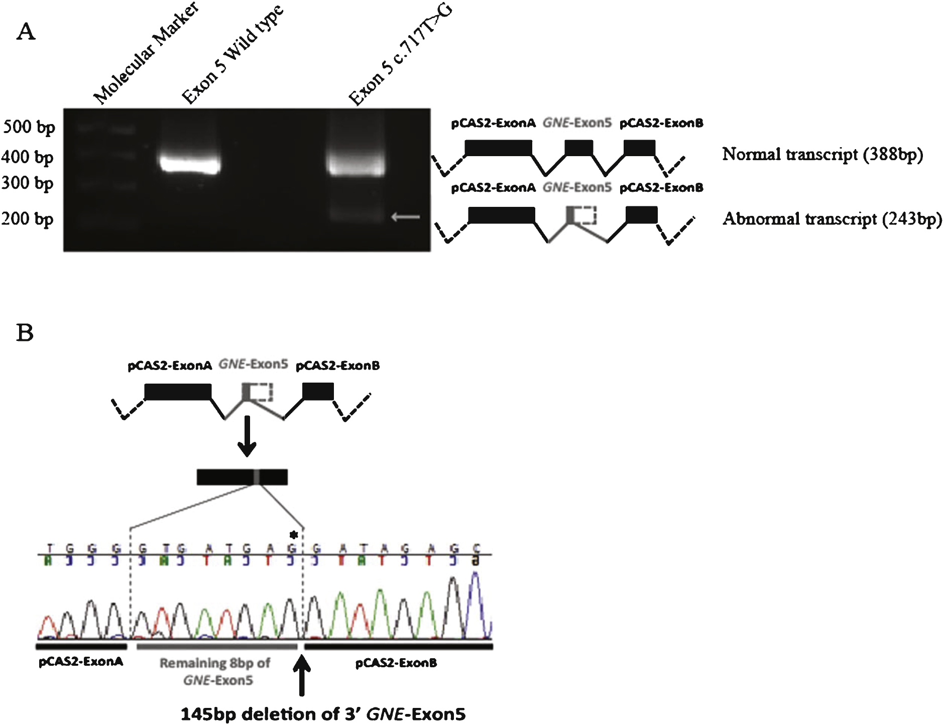 Transcriptional analysis of the GNE variant c.717T>G using an in vitro minigene splicing assay. Transfection into HEK 293 cells was performed both using a wild type (Exon 5 WT) construction and the mutant pCAS2 construction (Exon 5 c.717T>G). Forty-eight hours after transfection, transcriptional analysis was performed and the effect on splicing identified using RT-PCR was further confirmed using Sanger sequencing. A. RT-PCR analysis identifies the presence of an abnormally spliced transcript (arrow) in HEK 293 cells transfected with the mutant pCAS2 construction (Exon 5 c.717T>G), as compared to cells transfected with the wild type (Exon 5 WT) construction. B. Sequence analysis of the different transcripts identifies for the abnormally spliced transcript a 145 bp deletion of the 3’ extremity of exon 5, correlating with the activation of a cryptic splice-donor site caused by the c.717T>G variant (indicated by  *).