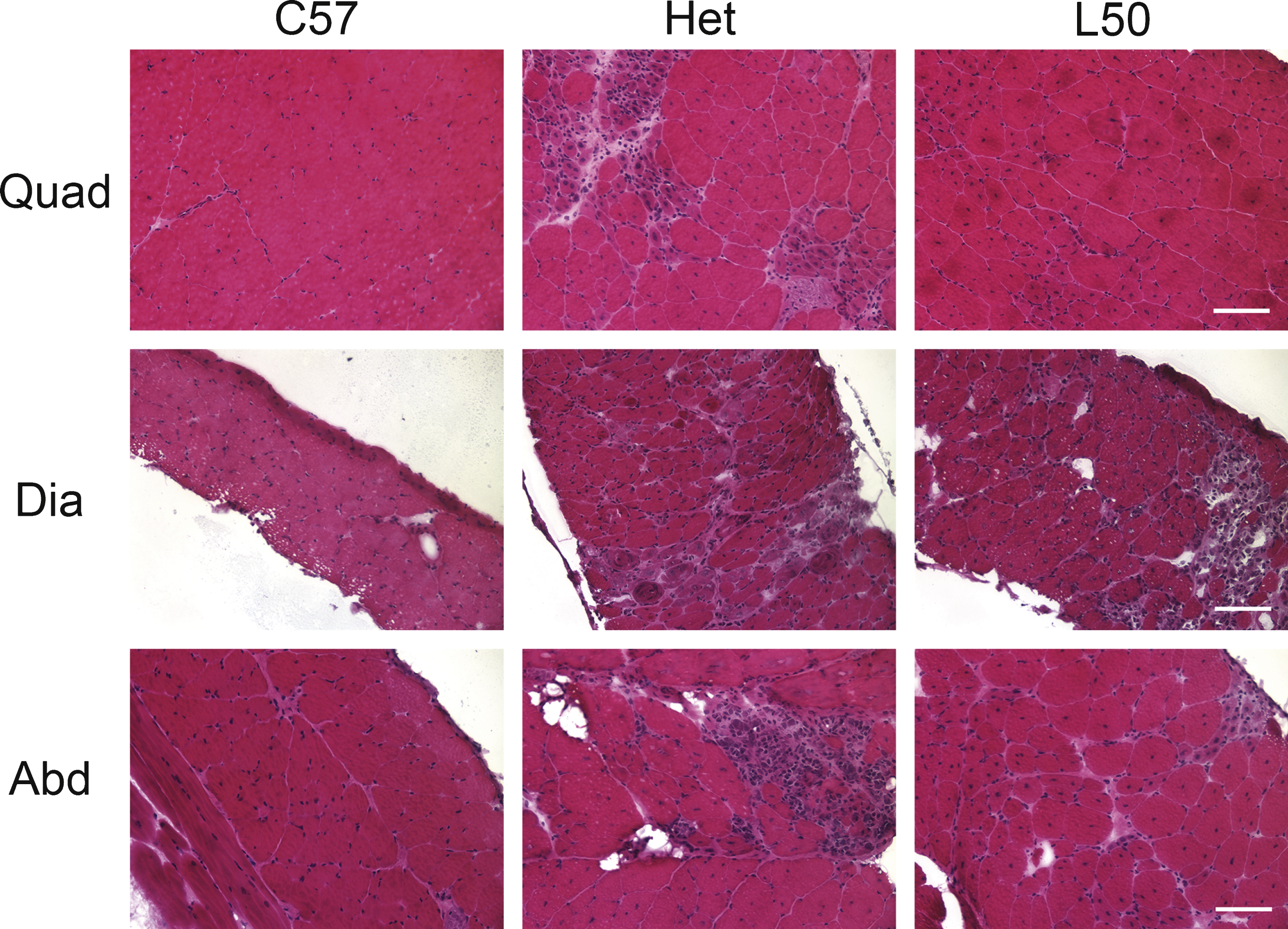 Hematoxylin and eosin stained representative quadriceps, diaphragm and abdominal sections. Het mice treated with 50 mg/kg × day of lisinopril had less observable overall muscle damage in quadriceps (Quad), diaphragm (Dia) and abdominal (Abd) sections compared to untreated het mice. As expected, C57BL/10 wild-type control mice had no observable muscle damage in any of the muscle types. C57: C57BL/10 wild-type control mice (n = 10); Het: untreated het mice (n = 10); L50: het mice treated with 50 mg/kg × day of lisinopril (n = 6). Bar = 100μm.