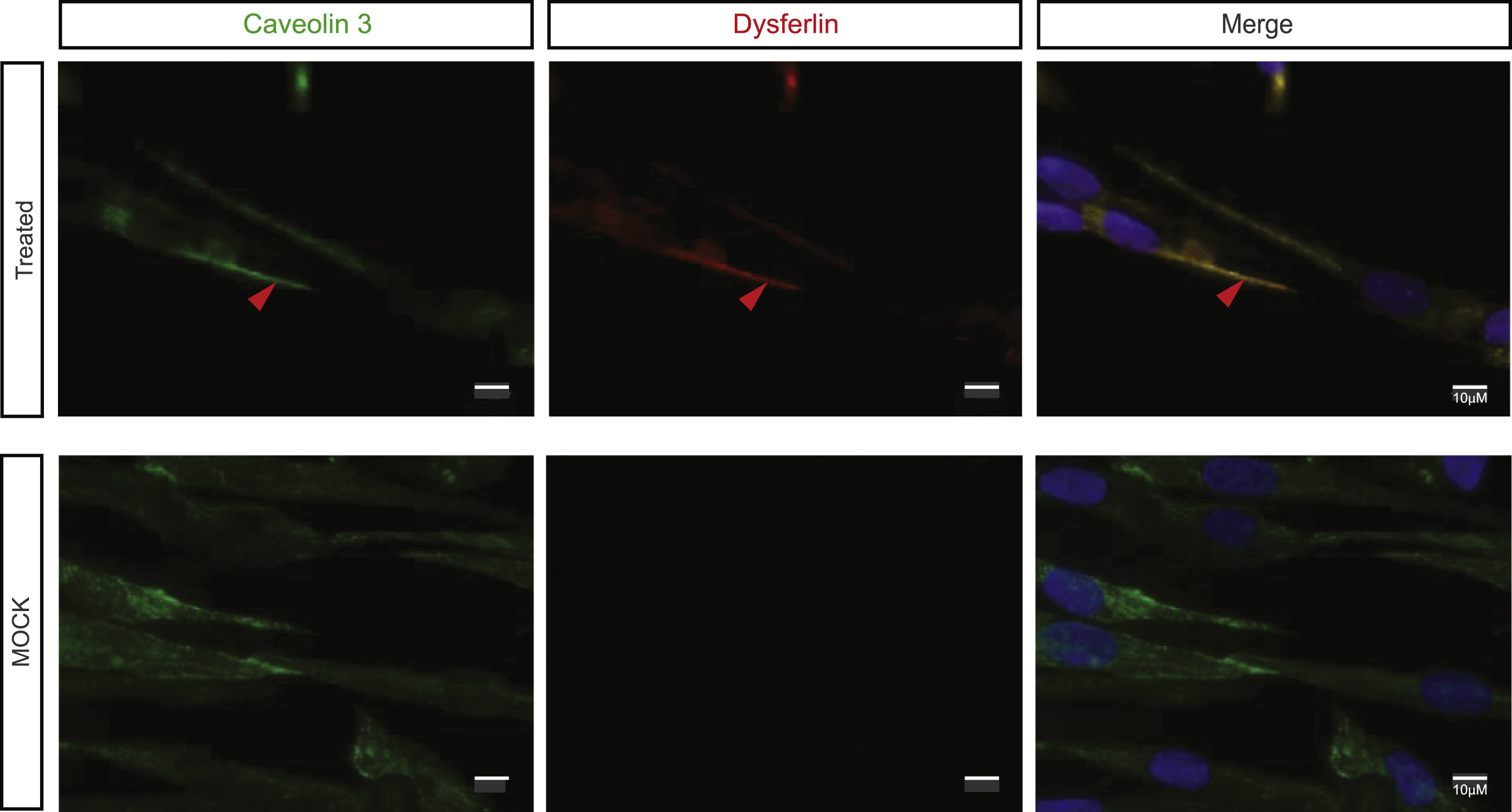 Exon 32-skipped dysferlin is correctly localized. Caveolin 3 labeling: maturation of myotubes and production of dysferlin were evidenced by Hamlet 1 labeling (Bars = 10 μm, arrow pointed to colocalized signal). DAPI was used as a nucleus marker. All images were captured by an apotome microscope.