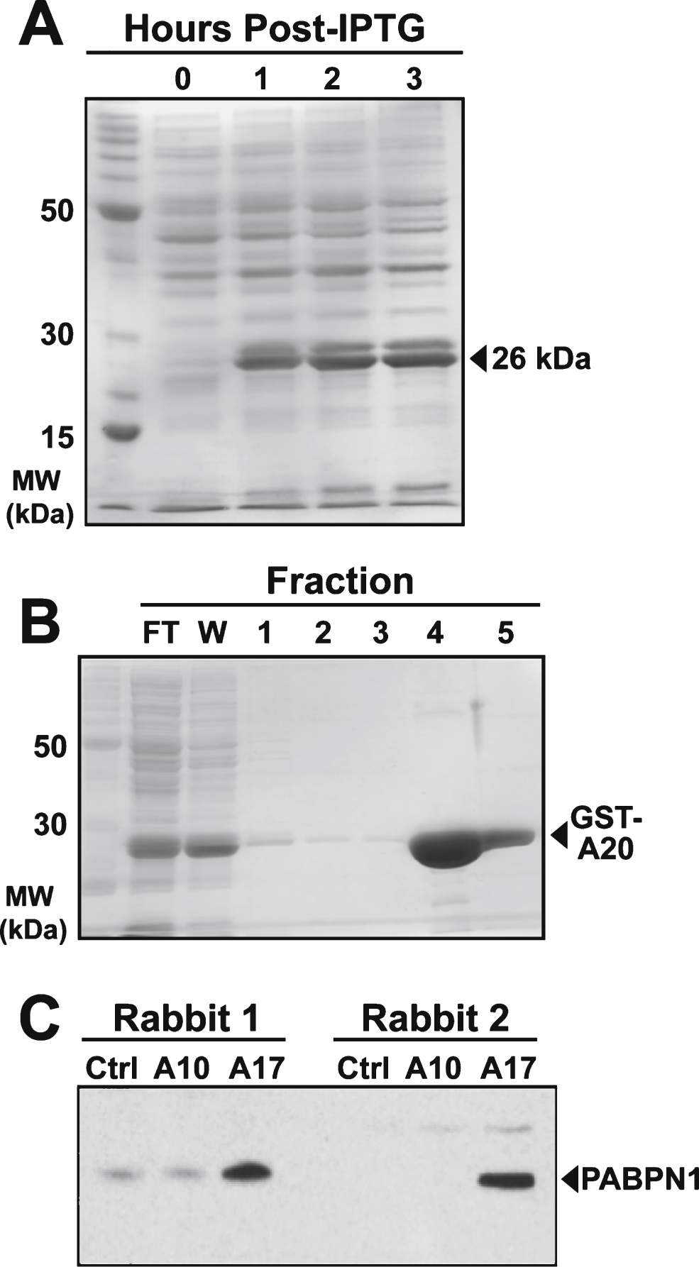 Production and purification of GST-A20 construct and generation of polyclonal antibody. A) Coomassie stained gel of bacterial lysates showing presence of the 26 kDa recombinant GST-A20 construct after inducing expression with IPTG for the indicated number of hours. B) Affinity purification of the GST-A20 construct by fractionation over glutathione sepharose resin and subsequent elution with reduced glutathione. The 26 kDa construct was detected in flow-through (FT) and the wash (W) and the majority was eluted in Fractions 4 and 5. C) Immunoblot of 50 μg of lysates from HEK 293 cells transfected with empty plasmid (Ctrl) or plasmid encoding wild type (A10) and alanine-expanded (A17) PABPN1 probed with sera from immunized rabbits. PABPN1 protein was detected as a 50 kDa band as indicated [19].
