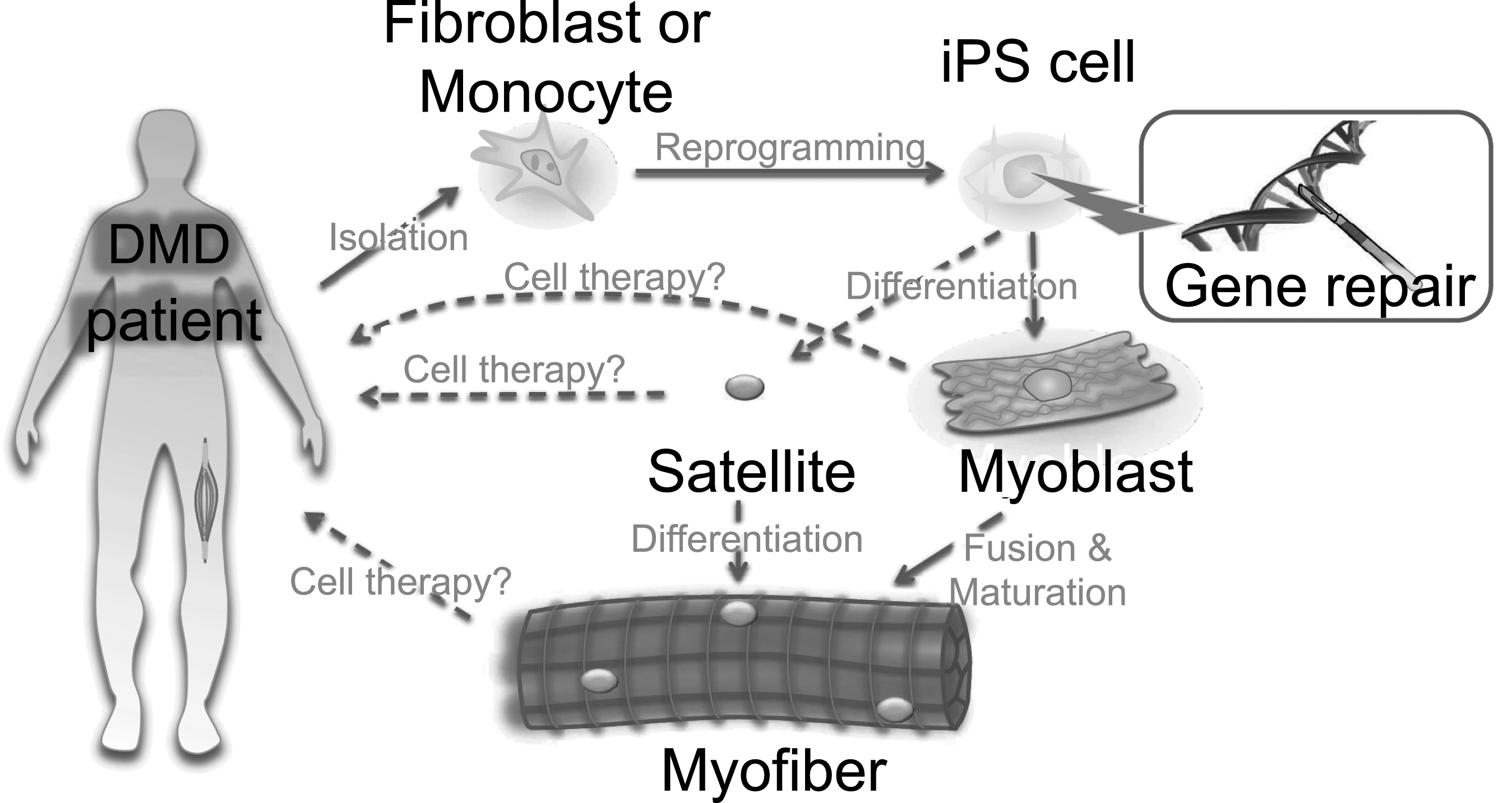 Ex vivo gene therapy approaches using iPS cells. A scheme for iPS cell-mediated ex vivo gene therapy approaches for DMD. Skin fibroblasts or monocytes from peripheral blood are reprogrammed to iPS cells by transient expression of the Yamanaka factors. The dystrophin mutation can then be repaired using genome engineering technologies. Such corrected iPS cells can be further differentiated into myoblasts to form myofibers. Either myoblasts or myofibers can be transplanted to patients, but only for transient recovery, as myoblasts or myofibers will eventually die after cellular turnover. An ideal approach would be to differentiate iPS cells into satellite cells, which are muscle stem cells, to gain long-term self-renewal and regeneration capacity in the myofibers. Currently, ex vivo expansion of primary satellite and genome editing is challenging, but progress here could circumvent the use of iPS cells.