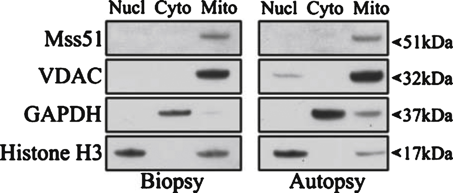 Subcellular localization of MSS51. Subcellular fractionation was performed on human deltoid samples from a biopsy and an autopsy and resulting fractions were subjected to SDS-PAGE. Immunoblotting was performed with the only current antibody specific to MSS51 (anti-human MSS51, Acris Antibodies, San Diego, CA, USA) showing a band in the mitochondrial fraction of the predicted protein product size, 51 kDa. Loading controls were VDAC (mitochondrial), GAPDH (cytoplasmic), and Histone H3 (nuclear).