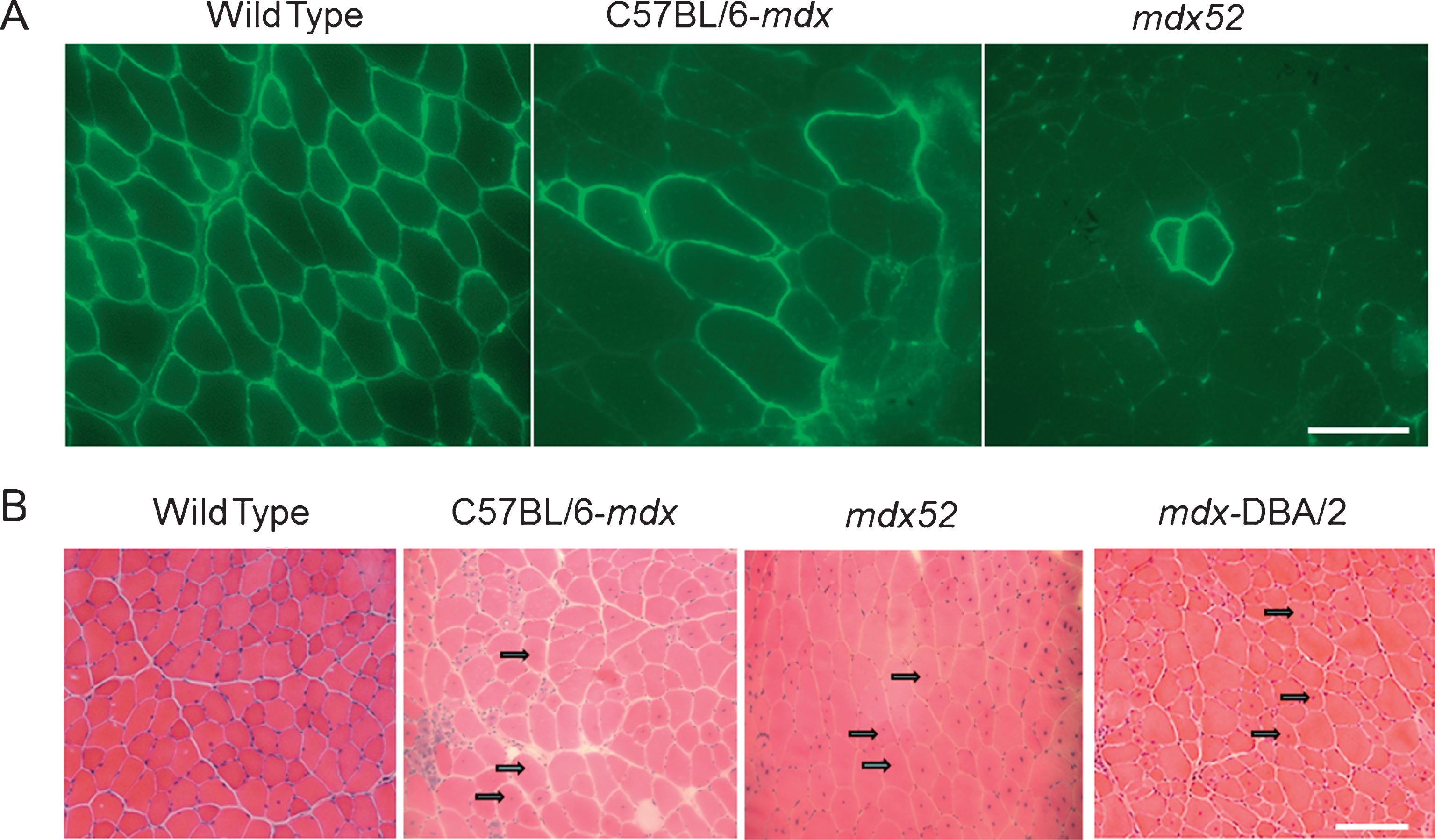 Histology concerning RF expression and CNFs observed in dystrophic mice models of mdx, mdx52 and/or mdx-DBA/2) (A) Mdx52 mice show lower number of RFs in a single cluster than mdx52 mice at 12 months of age. Echigoya et al., 2013 showed that mdx52 has a 58% lower RF expansion than age-matched mdx mice of 12 months. The tibialis anterior (TA) muscles of mdx and mdx52 were immunostained with a rabbit polyclonal antibody against C-terminal domain (position at 3,661– 3,677 amino acids; Abcam, Bristol, UK). Bars = 50μm. (B) Hematoxylin and eosin stained images for TA muscles of mdx, mdx52 and mdx-DBA/2 mice at 2 months of age. Arrows indicate centrally nucleated fibers. Bars = 100μm.