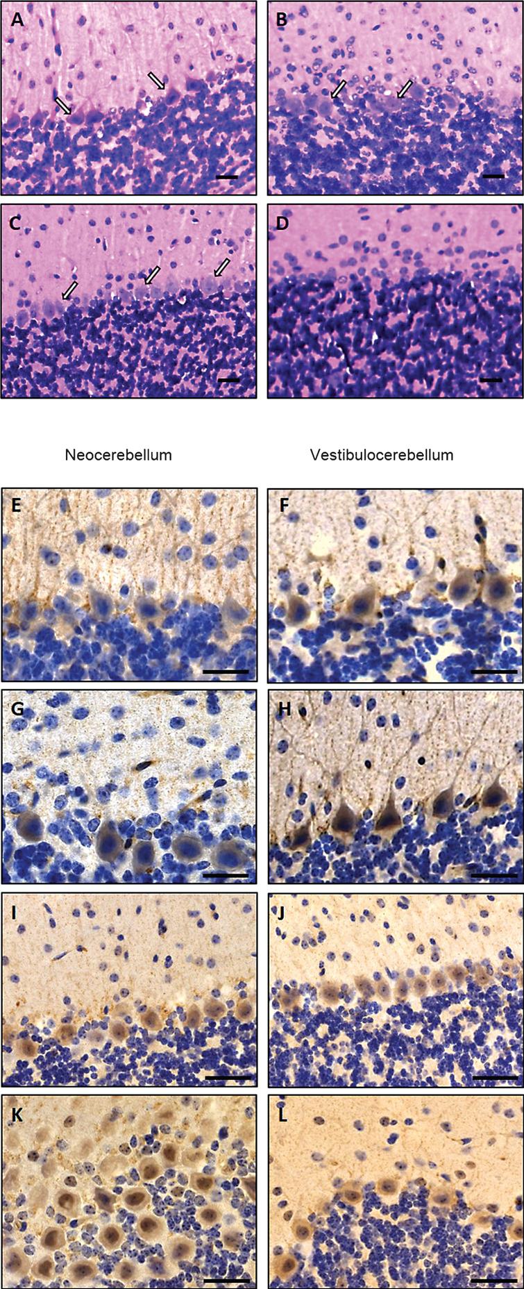 Cerebellar alterations in woozy mice. H&E: (A) Purkinje cell layer (white arrows) and absence of glial cell proliferation in a 6-week-old wild type littermate control. Scale bar = 20 μm. (B) Occasional mislocalisation of Purkinje-cells (white arrows) and proliferated (Bergmann) glial cells in a 6-week-old woozy mouse. Scale bar = 20 μm. (C) Purkinje-cell layer (white arrows) and absence of glial cell proliferation in a 26-week-old wild type littermate control. Scale bar = 20 μm. (D) Complete loss of Purkinje cells in a 26-week-old woozy animal. Scale bar = 15 μm. Immunohistochemistry: (E–L) Purkinje cells in the neo- and vestibulocerebellum of 6 weeks (E, G, I and K) and 26 weeks (F, H, J and L) old wildtype animals show enrichment of BCL2 in dendrites (E–H). Sil1-mutant Purkinje cells show decreased immunoreactivity in the neocerebellum (degenerating cells, G), but increased reactivity in Purkinje cells of the non-vulnerable vestibulocerebellum (surviving cells, H). (I–L) Investigation of PARP1 in Purkinje cells of woozy revealed increased immunoreactivity in the nuclei of neocerebellar Purkinje cells (K) but not in vestibulocerebellar Purkinje cells (L) compared to wildtype animals (I, J).