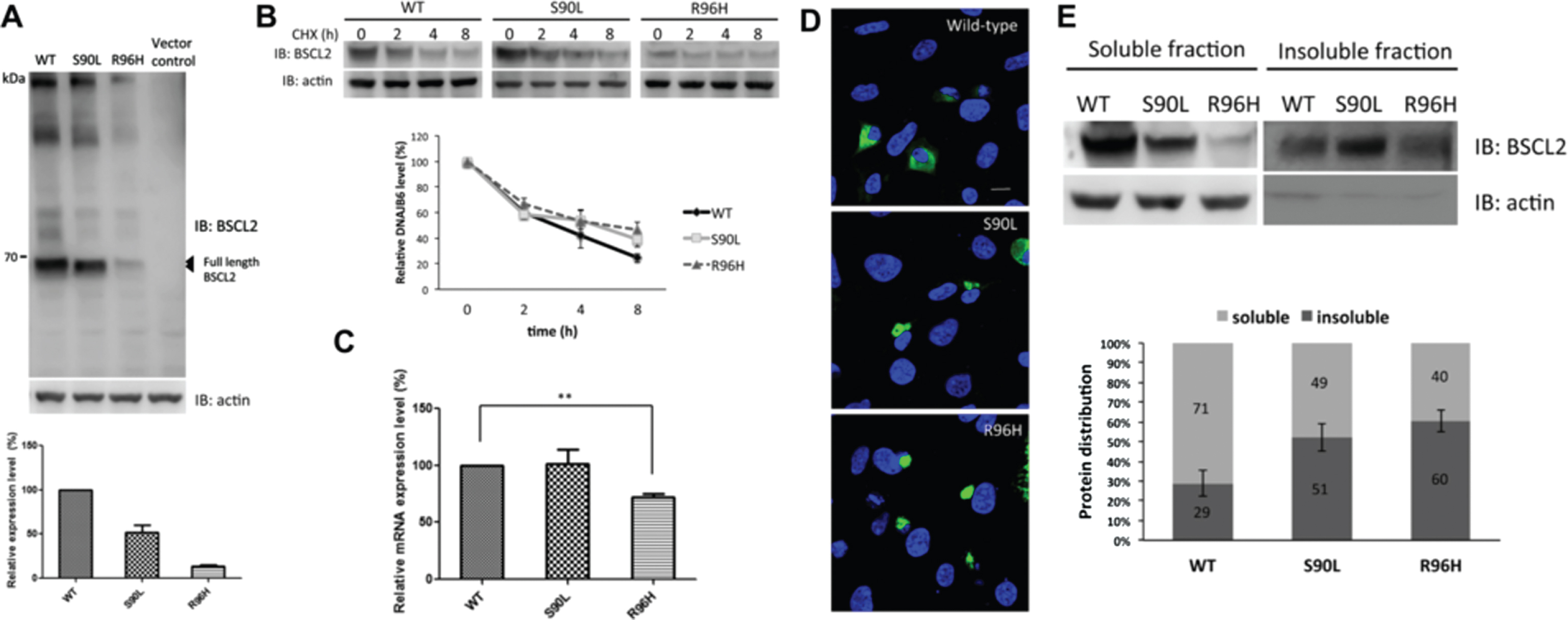 Fig. 2. In vitro expression of BSCL2 and the characterization of wild-type (WT) and mutant seipin proteins in HEK293T cells.
