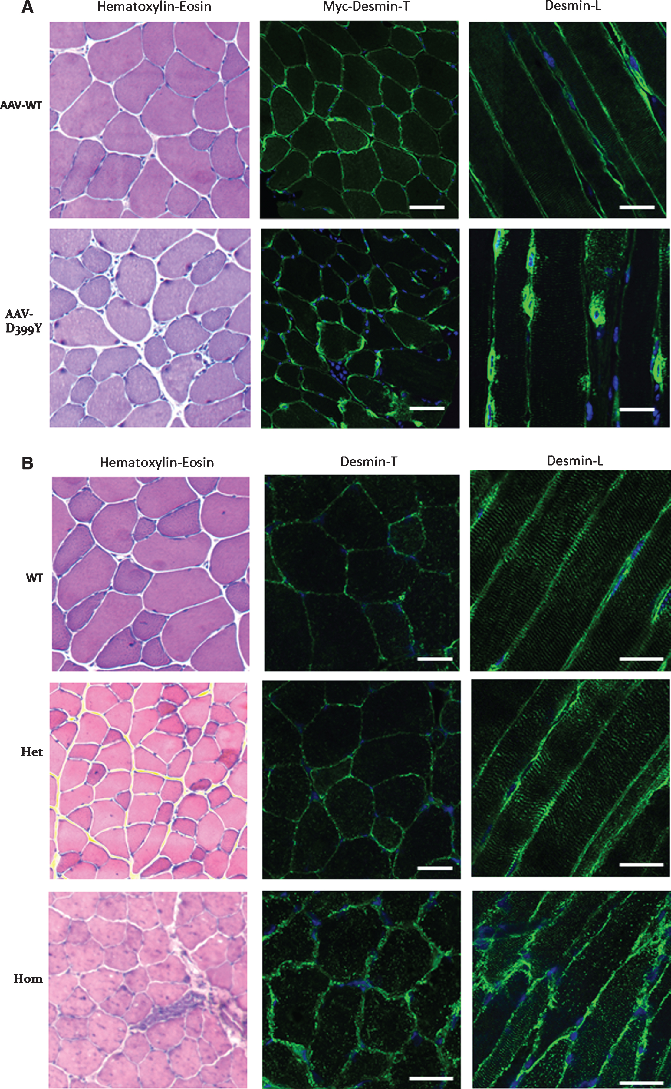 Altered desmin subcellular distribution in skeletal muscle tissue. A- 11-week-old mice (C57bl6J) were injected in tibialis anterior (TA) with associated-adeno-virus (AAV) encoding Myc-tagged wild-type (WT) or D399Y desmin. One month later, TA were extracted and frozen, and Myc immunostaining on transverse or longitudinal cryosections was performed to detect exogenous desmin. D399Y shows a perinuclear accumulation related to human desmin aggregation observed in patients. Scale bar = 20 μm. B- DesKI-R405W mice (homologous to R406W mutation in human, C57bl6N) were analyzed at 3 months old. Briefly, TA were extracted and frozen and desmin immunostaining was performed on transverse or longitudinal cryosections to detect endogenous desmin in homozygous (Hom), heterozygous (Het) or wild-type (WT) mice. A typical desminopathy staining pattern with predominantly subsarcolemmal and also sarcoplasmic desmin-positive protein aggregates can be observed in homozygous tissue. Moreover, a regular cross-striated desmin pattern is present in WT mice, and mainly preserved in HET mice, whereas Hom mice show an altered striation and fiber shapes. Scale bar = 20 μm.