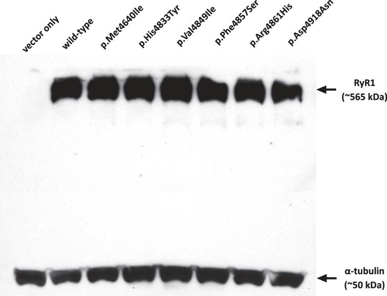 Expression of RyR1 protein in HEK-293T cells. Western blot showing RyR1 protein expression for each of the constructs in comparison with α-tubulin as a loading control. Approximately 250 μg of total protein extract was loaded in each lane. Variants are indicated by their amino acid change.