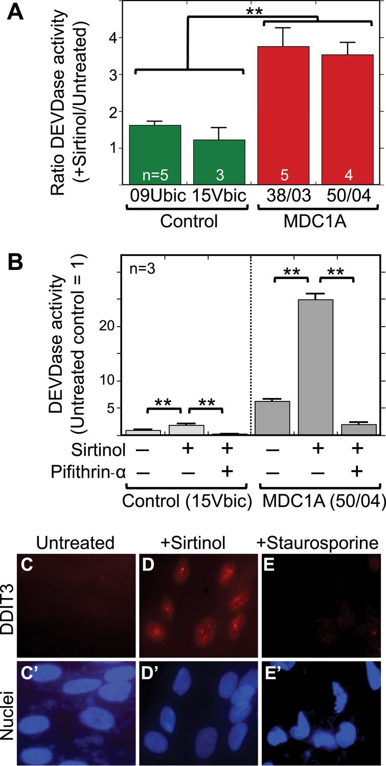 Sirtinol treatment increased caspase activity in MDC1A cells in a p53-dependent process and also induced nuclear accumulation of the ER stress marker DDIT3 (CHOP). A. Treatment with sirtinol at 5μM for 24 h caused a 3–4X increase in caspase 3/7 (DEVDase) activity in differentiated cultures of 38/03 and 50/04 MDC1A myogenic cells, but had little effect on caspase activity in cultures of 09Ubic and 15Vbic healthy control myogenic cells. **P < 0.01 by ANOVA with n as indicated. B. As in panel A, treatment with sirtinol at 5μM for 24 h was accompanied by a 3–4X increase of caspase (DEVDase) activity. This sirtinol-induced caspase activation was prevented when 25μM pifithrin-alpha was added at the same time as sirtinol, indicating that the sirtinol-induced caspase activation was p53 dependent. For healthy controls, 15Vbic cells were used. For MDC1A, 50/04 cells were used. Error bars = SE. **P < 0.01 by ANOVA with n = 3. C-E. Differentiated MDC1A 50/04 cultures were treated with sirtinol (5μM for 24 h) or staurosporine (1μM for 4.5 h), i.e., conditions we had previously shown to increase caspase (DEVDase) activity. Under these conditions, DDIT3 (also known as CHOP; red), a marker for ER stress, accumulated in the nuclei (blue) of cells treated with sirtinol but not in the nuclei of untreated or staurosporine-treated cells. Though not shown, CHOP also accumulated in the nuclei of sirtinol-treated healthy control cells 15Vbic. Bar in panel C = 20μm.