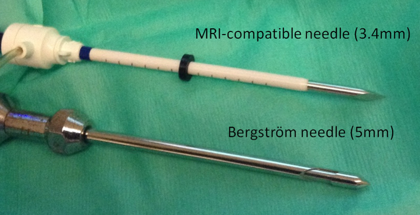 MRI-guided biopsy needle. Comparison between 3.4 mm MRI-compatible needle for MRI-guided biopsy and 5 mm routine Bergström needle.
