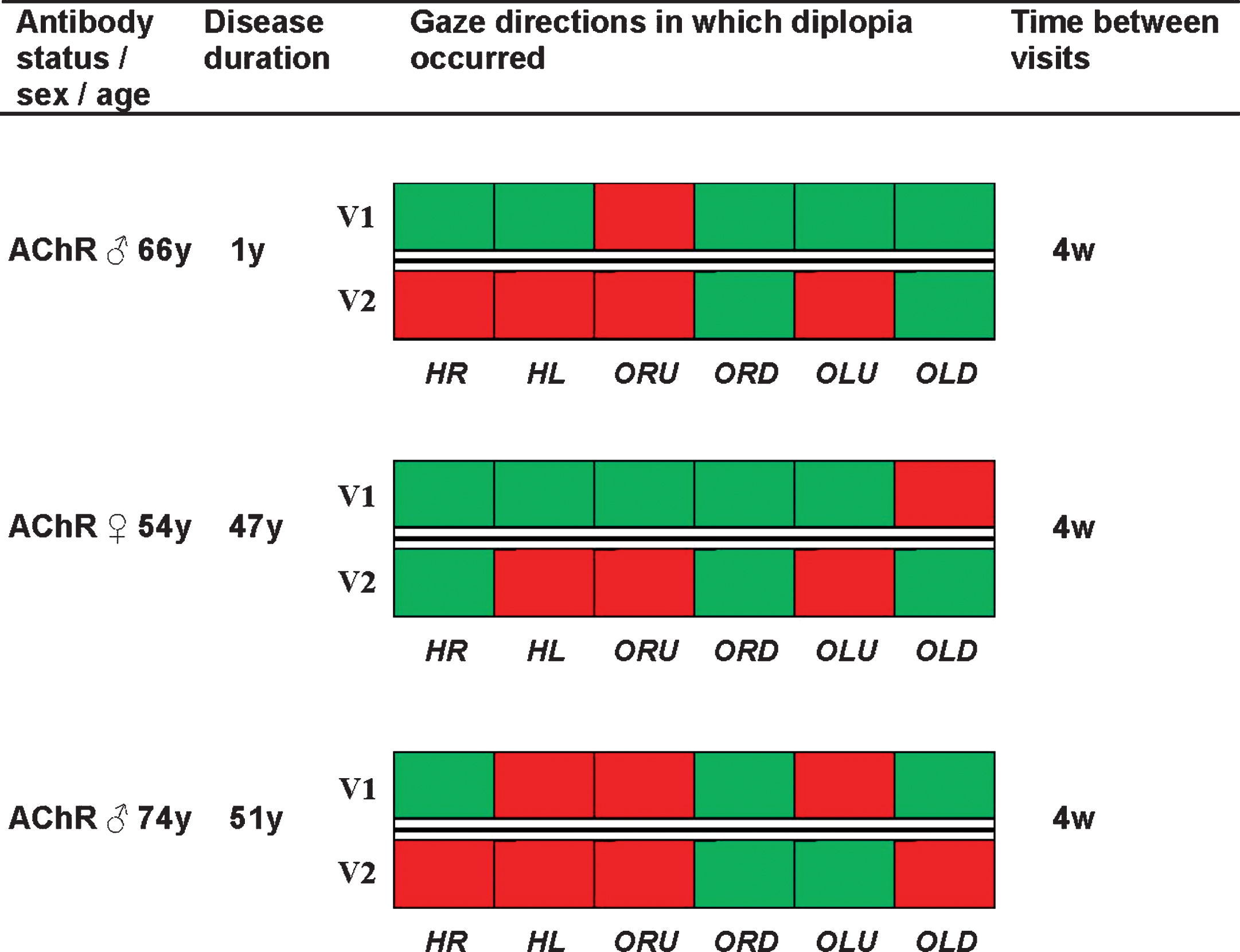 Changes of diplopia patterns in individual MG patients. Baseline characteristics and an overview of gaze directions in which diplopia occurred of three MG patients that had a substantial change of diplopia pattern at the second visit. Red indicates that diplopia occurred in that gaze direction and green indicates that no diplopia occurred in that gaze direction. Abbreviations: HR = horizontal right, HL = horizontal left, ORU = oblique right upward, ORD = oblique right downward, OLU = oblique left upward, OLD = oblique left downward.