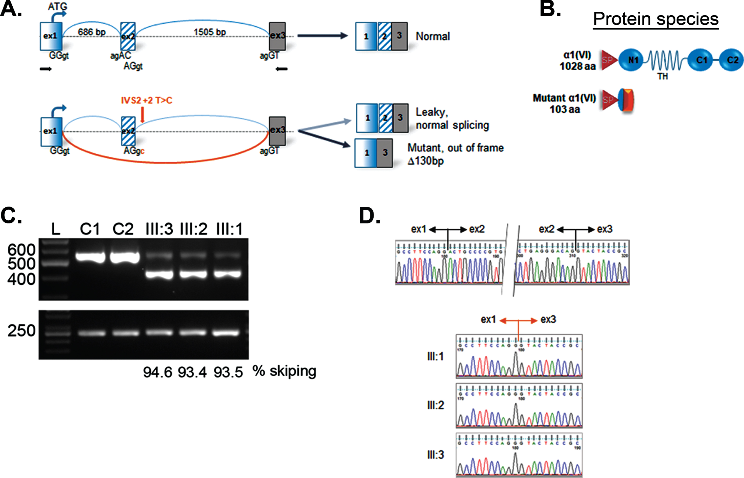 Skipping of exon 2 in COL6A1. Schematic representation of mutation effect on “leaky” splicing, which allows generating some normal transcripts and significant amount of mutant transcript with deletion of 2 exon having a size of 130 bp in patient (A); scheme of normal full-length (1028 aa) and mutant protein α1 (VI) 103 aa; SP –signal peptide; TH –triple helical domain; C1–C2 -terminal domains (B); RT-PCR gel showing an additional faster migrating band in the patient lanes (III:1; III:2; III:3), but not in the normal controls (C1, C2) (C); sequencing chromatogram of cDNA representing the upper normal band (top) and lower band in patient III:1, III:2, III:3 revealing the loss of sequence corresponding to exon 2. RPLP0 was used as reference gene (bottom) (D). Sequencing profiles showing the boundaries of exons 1/2 and 2/3 in a control individual upper panel), while the deletion of exon 2 is evidenced in the 3 patients (lower panels).