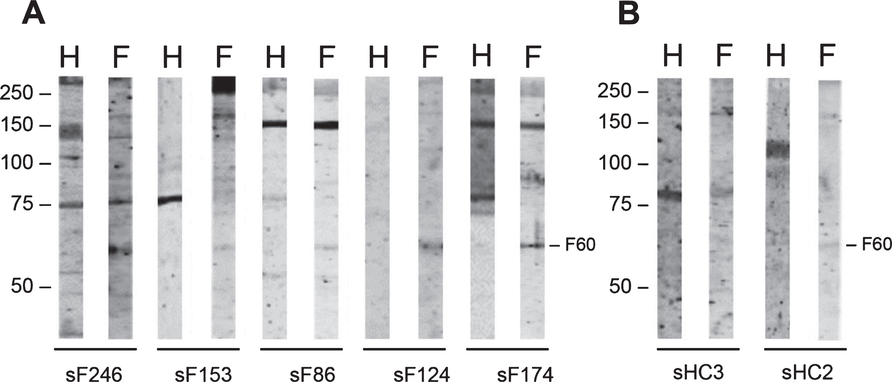 Reactivity of FSHD patient sera and HC sera with FSHD quadriceps muscle protein extract. FSHD muscle lysate (F) and, as a reference an extract from healthy muscles (H), was separated by SDS-PAGE and transferred to nitrocellulose membranes. Blot strips were incubated with 85 FSHD patient sera (sF) (A) and with 3 healthy control sera (sHC) (B). Data for only a few representative samples are shown. The left side of each panel indicates the position of molecular weight markers.
