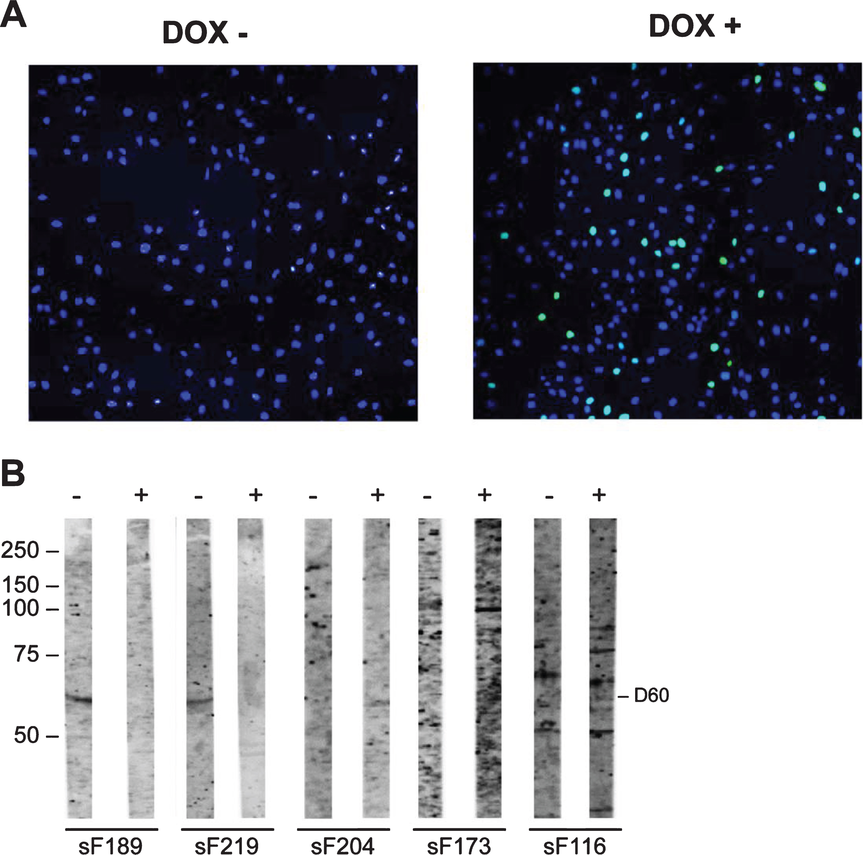 Reactivity of sera with DUX4-inducible myoblasts protein extract. Transfected myoblasts treated (DOX+) and non-treated with doxycycline (DOX-) were stained with DAPI (blue) and with an anti-DUX4 antibody (green) (A). DUX4-expressing myoblast protein extract (+) and control myoblast protein extract (–) were separated by SDS-PAGE and transferred to nitrocellulose membranes. Blot strips were incubated with 86 FSHD patient sera (sF) (B) and with 3 HC sera. Panel contains a representative set of tested samples. On the left the positions of molecular weight markers are indicated.