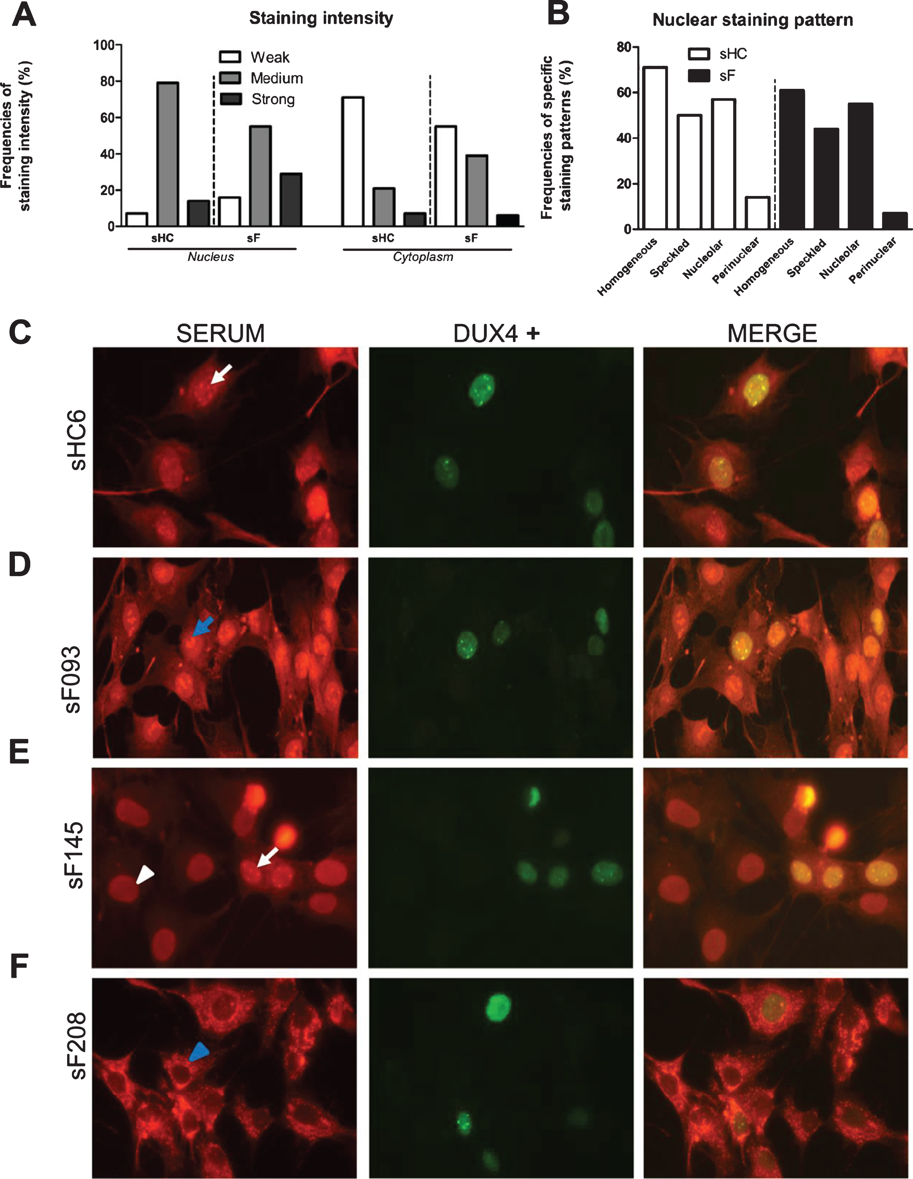 Immunofluorescence analysis of the reactivity of FSHD and HC sera with DUX4-expressing myoblasts. DUX4-expressing myoblasts were fixed and incubated with either patient (N = 85) or control sera (N = 14) and with an anti-DUX4 antibody. Bound antibodies were visualized by fluorescent secondary antibodies. (A) Nuclear and cytoplasmic staining intensity frequencies scored as weak, medium, and strong. (B) (Peri)nuclear staining pattern frequencies. (C - F) White arrows indicate nuclear speckles; blue arrows indicate nucleolar staining; white arrowheads indicate homogeneous nuclear staining; blue arrowheads indicate perinuclear staining in the cytoplasm. sF = FSHD serum. sHC = healthy control serum. A representative set of samples is shown.