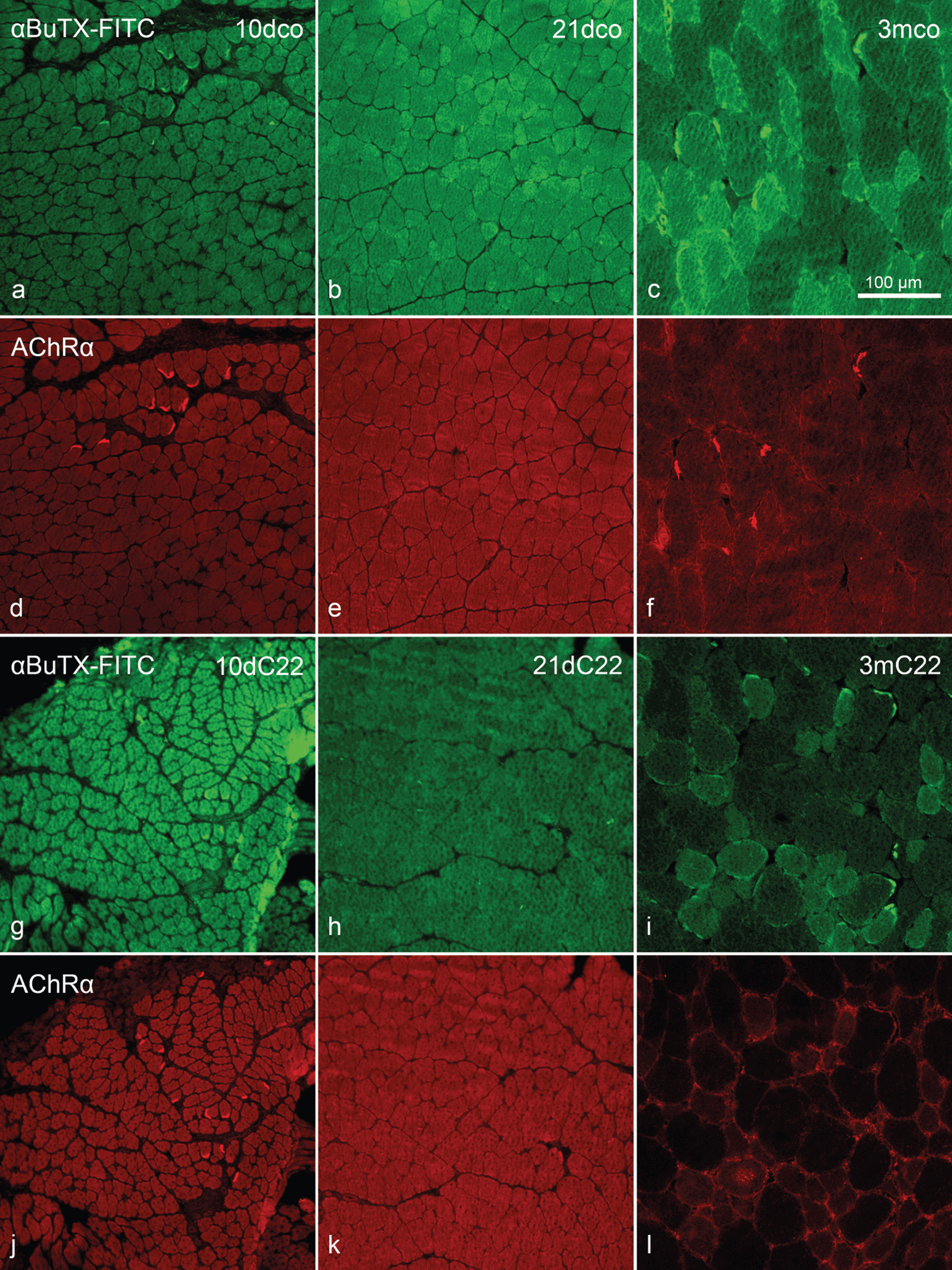 Detection of acetylcholine receptor α-subunit by (immuno)histochemistry. Double staining FITC-conjugated α-bungarotoxin (α-BuTX-FITC; a–c and g–i) and anti-acetylcholine receptor (α-subunit) (aAChRα; d–f and j–l). 10dco (a, d), 10dC22 (g, j), 21dco (b, e), 21dC22 (h, k), 3mco (c, f) and 3mC22 (i, l). Intense reactivity at neuromuscular endplates in a, c, d, f, g, i, j and l, but on extrajunctional sarcolemma only in l and –weaker –i. Note that while all images of a staining were acquired with identical exposure times, settings etc., further processing for presentation are identical between age groups only. This is due to changing background reactivity, in particular in the mouse-on-mouse situation, in the different ages. Primary magnification was 20fold, scale bar in (c) indicates 100μm for all images.