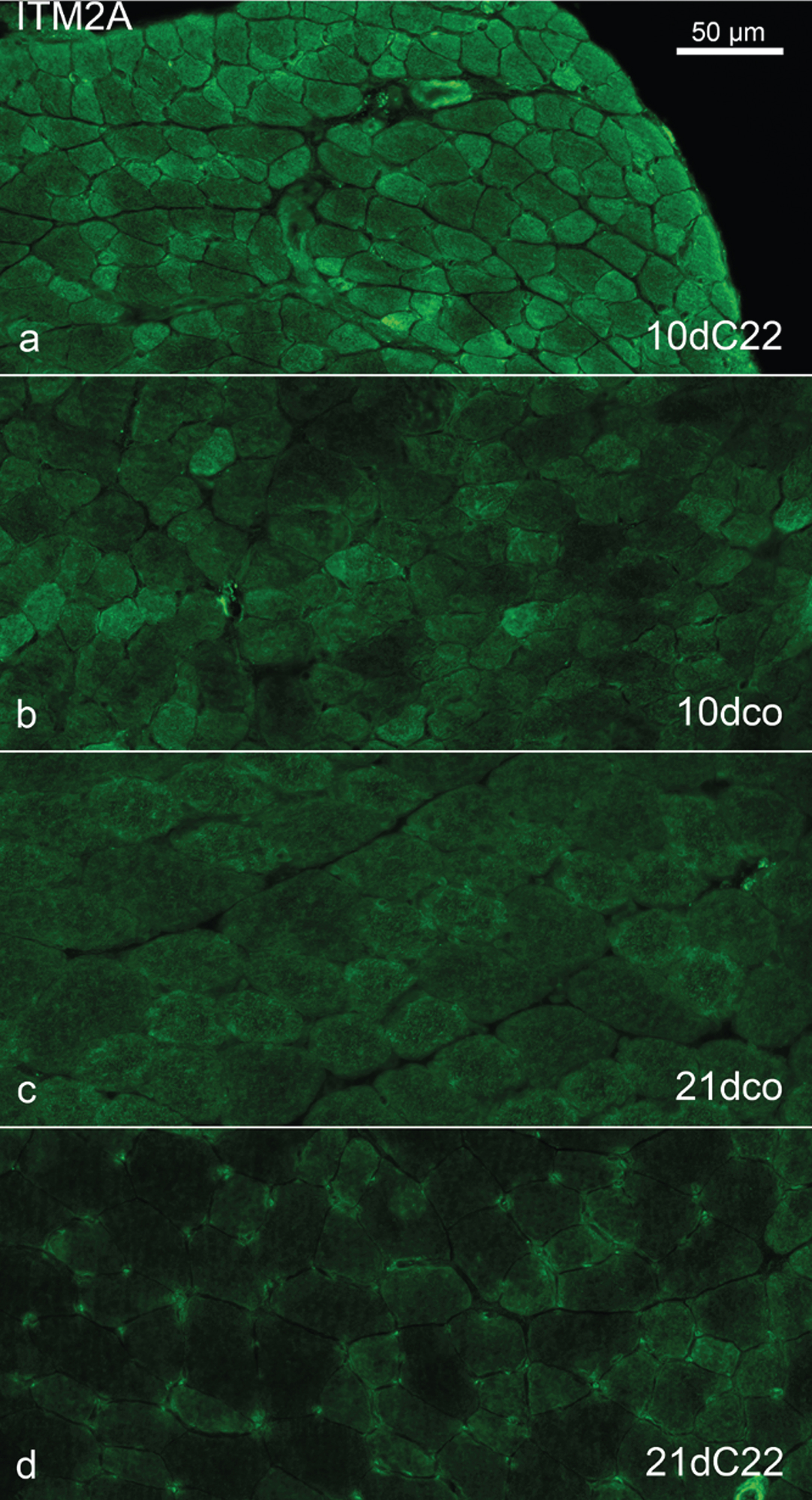 Comparison of anti-ITM2A immunohistochemistry in samples of the young mouse groups. Anti-ITM2A immunohistochemistry of TA muscles from 10dC22 (a), 10dco (b), 21dco (c) and 21dC22 (d), identical exposure time, settings etc. and image processing throughout. Note gradient of muscle fibre reactivity. Primary magnification was 40fold, scale bar in (a) indicates 50μm for all images.