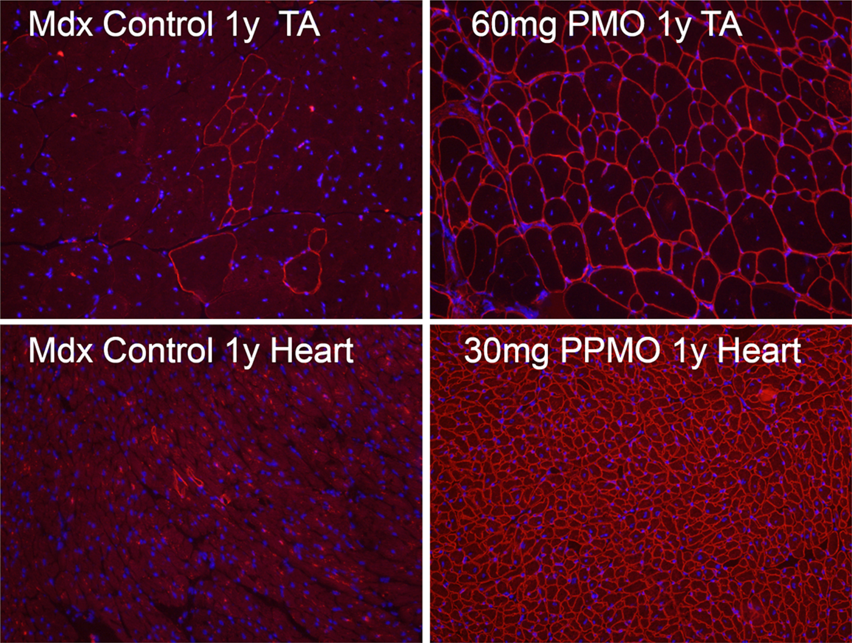 Revertant fibers in skeletal and cardiac muscles (Control, left panel) of mdx mice and mdx mice treated for 1 year (1y) with 60 mg/kg morpholino (PMO, upper right) and 30 mg/kg peptide-conjugated morpholino (PPMO, lower right) antisense oligonucleotide targeting exon 23 of dystrophin gene. Dystrophin is recognized with primary rabbit anti-dystrophin antibody P7 and detected by donkey anti-rabbit Alexa Fluor 594. Nuclei (blue) are stained with DAPI.