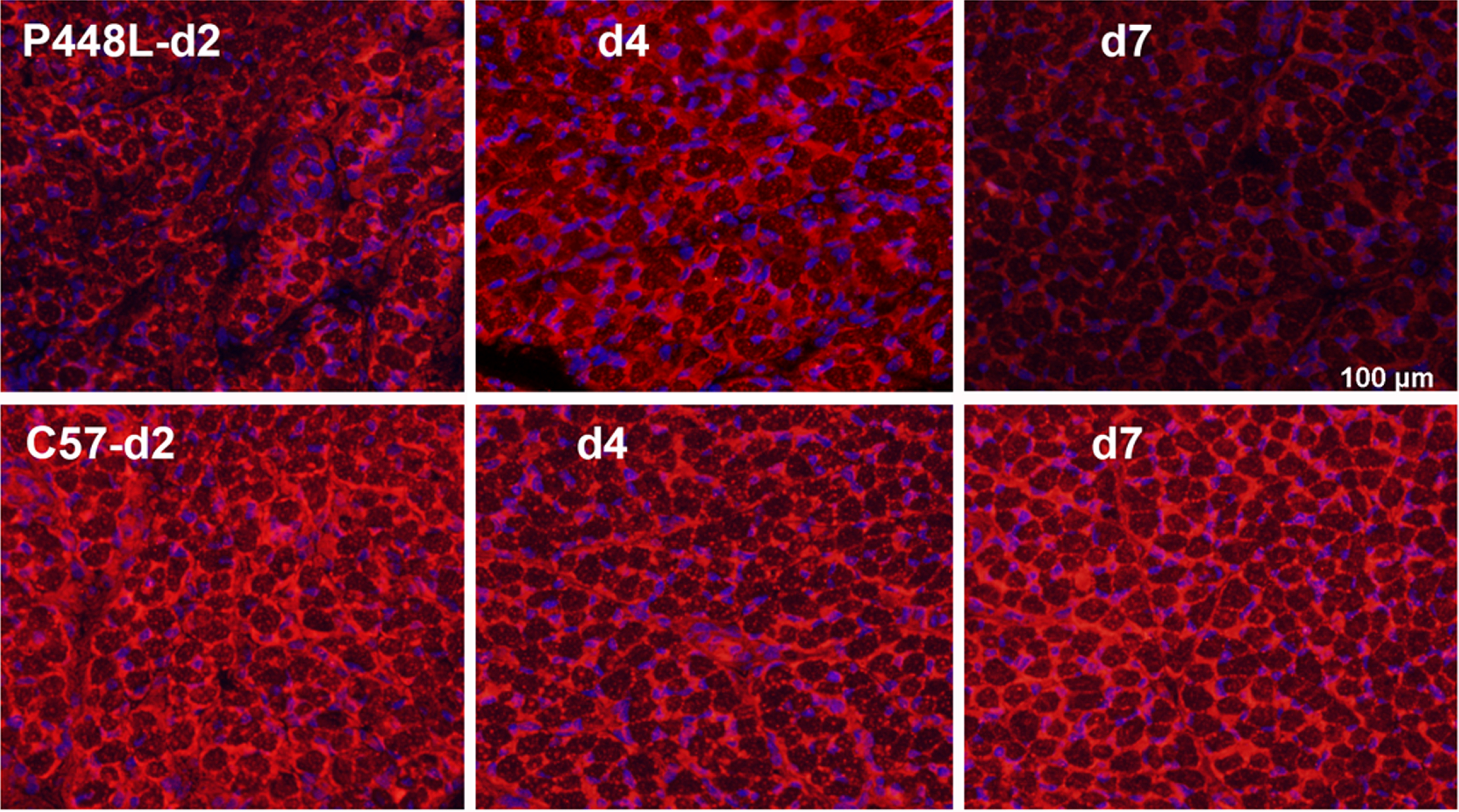 Matriglycan expression in new-born P448L FKRP mutant mice at postnatal day 2 (d2) to day 7 (d7) in comparison with C57 normal mice. Matriglycan (red) on α-DG is recognized by primary monoclonal antibody IIH6((EMD Millipore) (1:500) and detected with secondary Alexa Fluor 594 goat anti-mouse (Invitrogen). Except membrane localized signal, there is also diffuse cytoplasmic staining of the early myofibers as observed in the newly regenerated myofibers. Nuclei (blue) are stained with DAPI.