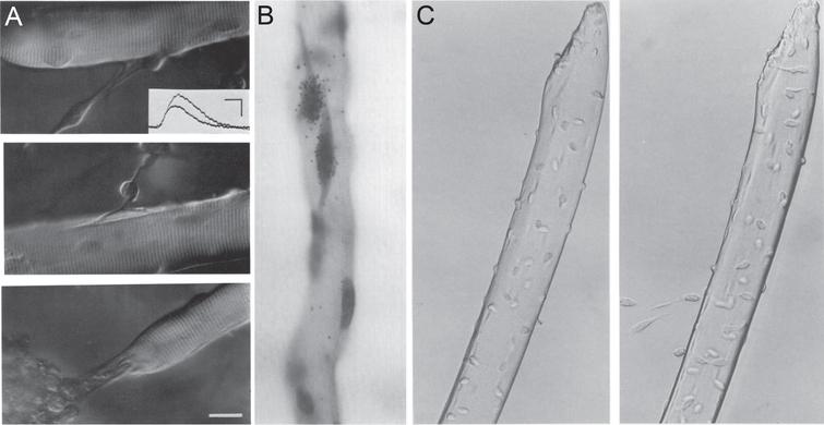 Isolation of muscle fibres to obtain satellite cells in their niche. (A) Three examples of muscle fibres isolated from the flexor digitorum brevis of adult rat and cultured ex vivo for 6-9 days, exhibiting attached cellular processes, from Bekoff and Betz, 1977 [47]. The authors were interested in modeling denervation, with this figure informing on acetylcholine sensitivity of isolated fibres using an intracellular electrode (inset). Scale bar represents 20μm. (B) Muscle fibre from the flexor digitorum brevis of an adult rat from Bischoff, 1986 [8], isolated using a protocol optimized from Bekoff and Betz [47] to better preserve the satellite cell niche. Bischoff was investigating proliferation of satellite cells on isolated myofibres ex vivo and the effects of mitogens. Proliferation was measured via incorporation of tritriated thymidine and autoradiography (generating black grains of silver over radioactive areas), with Gill’s haematoxylin used to identify nuclei. The strongest effect on proliferation was from addition of chicken embryo extract (pictured here), followed by FGF. Magnification is x660. (C) Plated isolated myofibres from the extensor digitorum longus of an adult mouse with migrating satellite cells after 2 hours (left) and 24 hours (right) ex vivo, from Rosenblatt et al., 1995 [7]. The protocol was modified to allow isolation of longer myofibres from larger rodent muscles. Over time, satellite cells detach from the surface of the myofibre and proliferate on the matrigel substrate. Magnification is x300. Images as originally published but may have been cropped, and panel labels have been amended/rearranged/added.