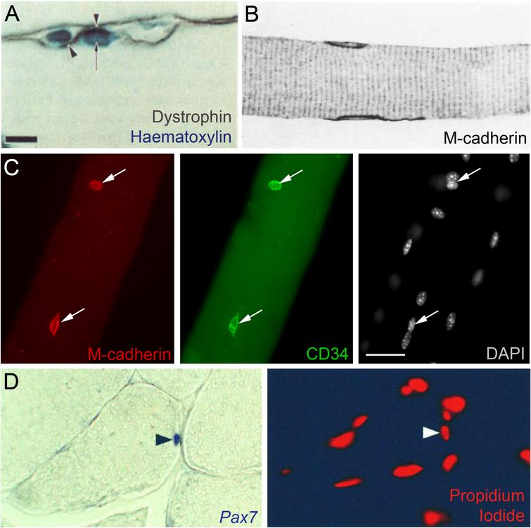 Markers to identify satellite cells in situ. (A) Indirect identification of a satellite cell in a rat muscle using immunolabeling from Zhang and McLennan, 1991 [81]. Dystrophin marks the plasmalemma of the muscle fibre (arrowheads) and two nuclei are visualized using haematoxylin. Satellite cells were distinguished from other nuclei including myonuclei (arrow) by their location outside the dystrophin-labeled plasmalemma but under the basal lamina (using collagen IV immunolabelling - not shown). Scale bar equals 10μm. (B) M-cadherin was shown to mark satellite cells in two papers in 1994 [90, 91], illustrated here with an image of ‘normal’ rat soleus muscle from Bornemann and Schmalbruch, 1994 [91]. The longitudinal section shows two satellite cells labeled with M-cadherin, which is mainly located at the satellite cell/muscle fibre interface. Magnification is x660. (C) CD34 on two satellite cells on an isolated mouse extensor digitorum longus myofibre, confirmed as satellite cells by M-cadherin co-immunolabeling (arrows), and distinct from myonuclei as revealed by DAPI nuclear counterstaining, from Beauchamp et al., 2000 [15]. Scale bar represents 30μm. (D) Pax7 as a satellite cell marker from Seale et al., 2000 [9]. In situ hybridization was used to show that Pax7 mRNA was expressed in approximately 5% of peripherally-located muscle nuclei in healthy adult mouse tibialis anterior muscles (left) with a propidium iodide nuclear counterstain (right). Arrowheads indicate the Pax7-expressing nucleus. Magnification is x200. Images as originally published but may have been cropped, and the panel labels have been amended/rearranged/added.