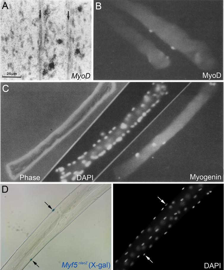 Myogenic regulatory factor expression in regenerating muscle and satellite cells. (A) In situ hybridization using a 35S-UTP labeled probe for MyoD in regenerating murine tibialis anterior muscle four days after crush injury, from Grounds et al., 1992 [127]. Hybridisation signal (silver grains) can be observed over some mononuclear cells but not over the newly formed myotubes (arrows). Scale bar represents 25μm. (B) MyoD immunolabeling of activated/proliferating satellite cells on an isolated myofibre from the flexor digitorum brevis of an adult rat after 2 days ex vivo, from Yablonka-Reuveni and Rivera, 1994 [52]. (C) Phase, DAPI nuclear counterstain and myogenin immunolabeling of a flexor digitorum brevis muscle fibre from an adult rat after 3 days ex vivo from Yablonka-Reuveni and Rivera, 1994 [52]. B and C illustrate that MyoD is followed by myogenin during myogenic progression in satellite cell progeny. (D) Isolated extensor digitorum longus myofibre from a Myf5nlacZ/+ mouse, with satellite cells localised by a blue precipitate from β-galactosidase activity from the nlacZ-targeted Myf5 allele following incubation in X-gal (left, arrows). DAPI counterstain (right) to visualize both satellite cell nuclei (arrows) and myonuclei, from Beauchamp et al., 2000 [15]. Images as originally published but panel labels have been amended/rearranged/added.