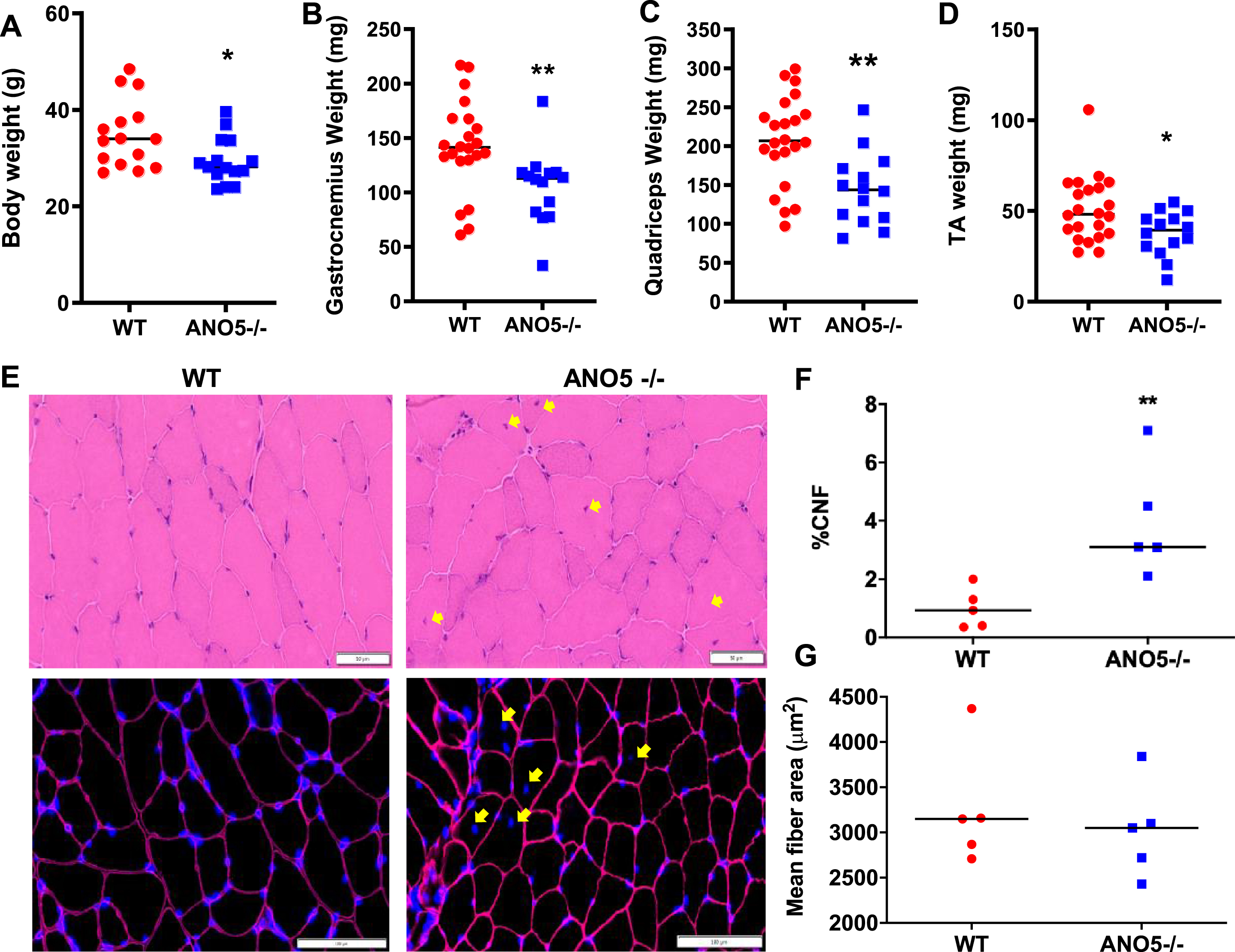 Effect of ANO5 deficit on muscle size and histopathology. Plots showing (A) body weight and weights of (B) Gastrocnemius, (C) Quadriceps, and (D) TA muscles. Each dot represents an individual mouse/muscle. Images showing cross sections of quadriceps muscle (E) stained with H&E (top) and for nuclei (DAPI) and basement membrane (Laminin immunostain) (bottom). Yellow arrows mark the centrally nucleated fiber (CNF) and these were quantified to measure (F) proportion of CNFs and (G) myofiber cross-sectional areas. Each dot represents value averaged from multiple cross sections per muscle, black line represents the median value of the distribution. Scale bars are 50 μm (top) and 100 μm (bottom). p values are measured by unpaired Mann-Whitney t test and indicated by *p < 0.05; **p < 0.01; A–D (n > 15), F, G (n = 5).