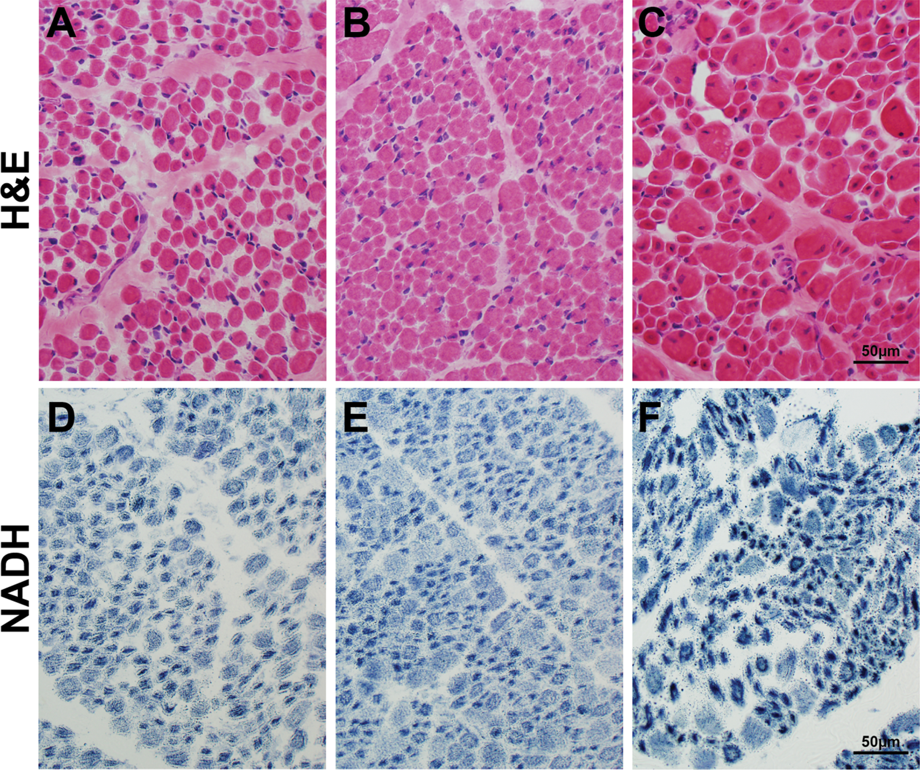 Muscle histopathology in autopsy tissue from patients with liver disease. Skeletal muscle tissue taken at autopsy from patients in the Congenital Muscle Disease Tissue Repository who showed variable degrees of liver pathology. H&E staining (A-C) reveals similar pathology that is characteristic of XLMTM, including myofiber smallness and increased numbers of fibers with internal nucleation, in the absence of inflammation or active myofiber degeneration. NADH staining (D-F) shows a pattern of organelle mislocalization that is characteristic of XLMTM in humans, with central aggregation of mitochondria and sarcotubular elements surrounded by an area of absent staining in the subsarcolemmal region. The muscle pathology findings in these three cases are extremely similar, despite differential levels of liver disease in these patients. One patient (panels A, D) had no histological evidence of liver disease, one patient (panels B, E) showed intrahepatic cholestasis at autopsy, and one patient (panels C, F) showed hepatic hemorrhage due to presumed hepatic peliosis.